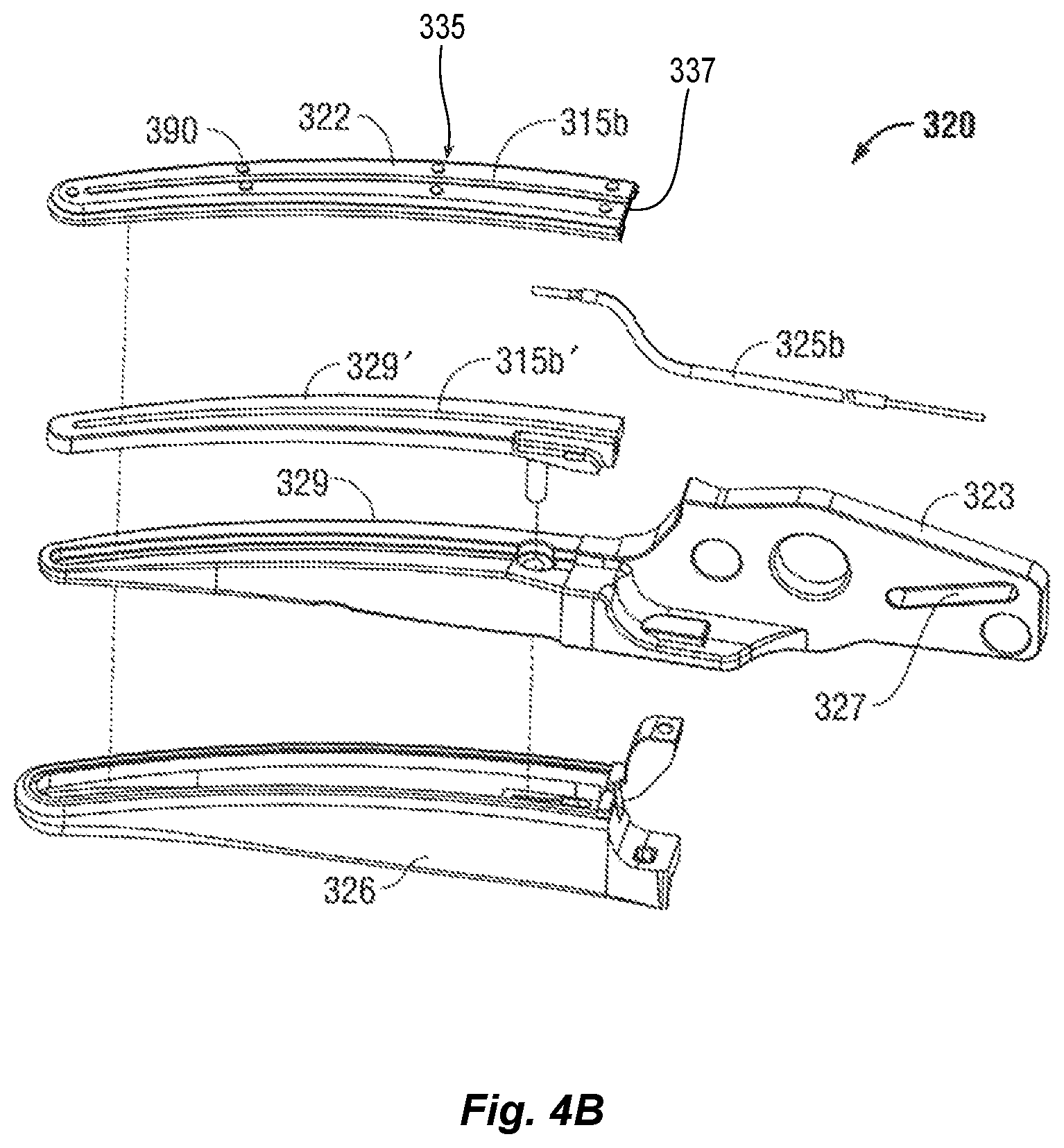 Patent US11779386 Figure 5 – Two-part seal plate for vessel sealer and method of manufacturing same