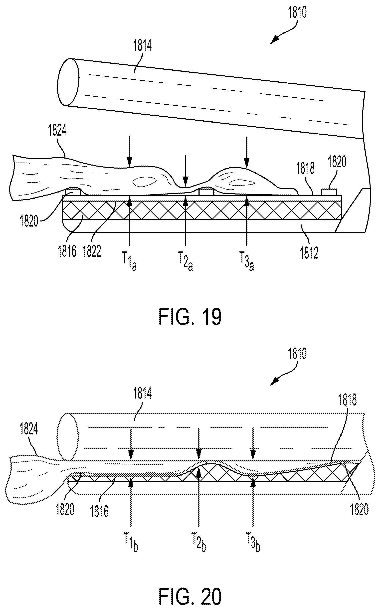 Patent US11779387 Figure 10 – Clamp arm jaw to minimize tissue sticking and improve tissue control