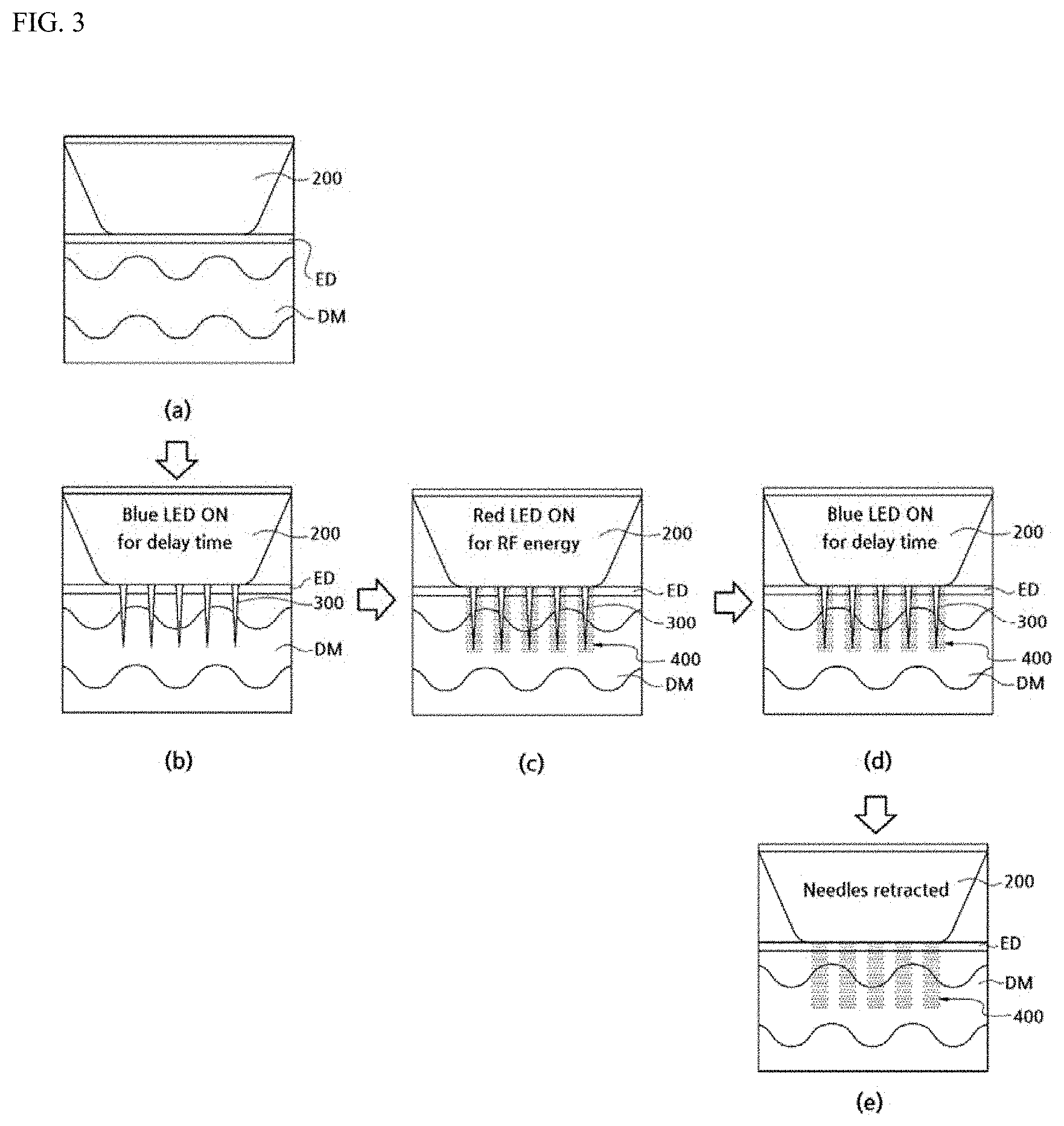 Patent US11779389 Figure 3 – Skin treatment device