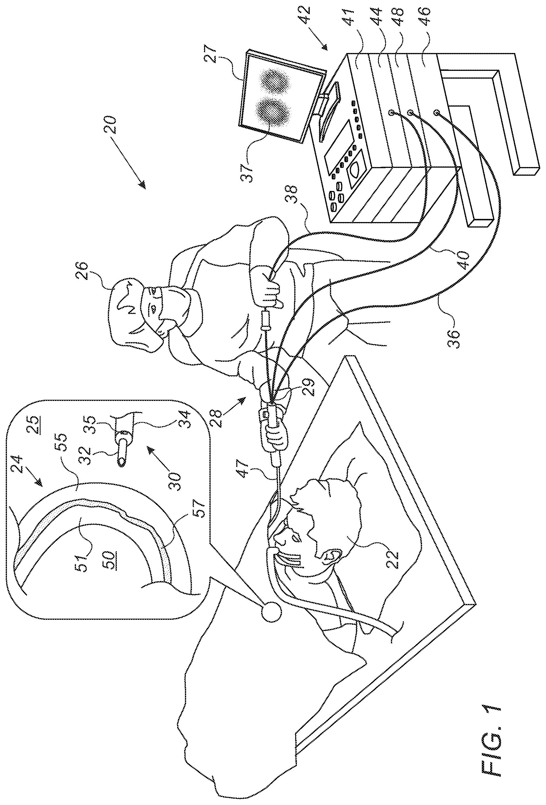 Patent US11779390 — Pericardium catheter including camera for guiding cutting through pericardium — Figure 1