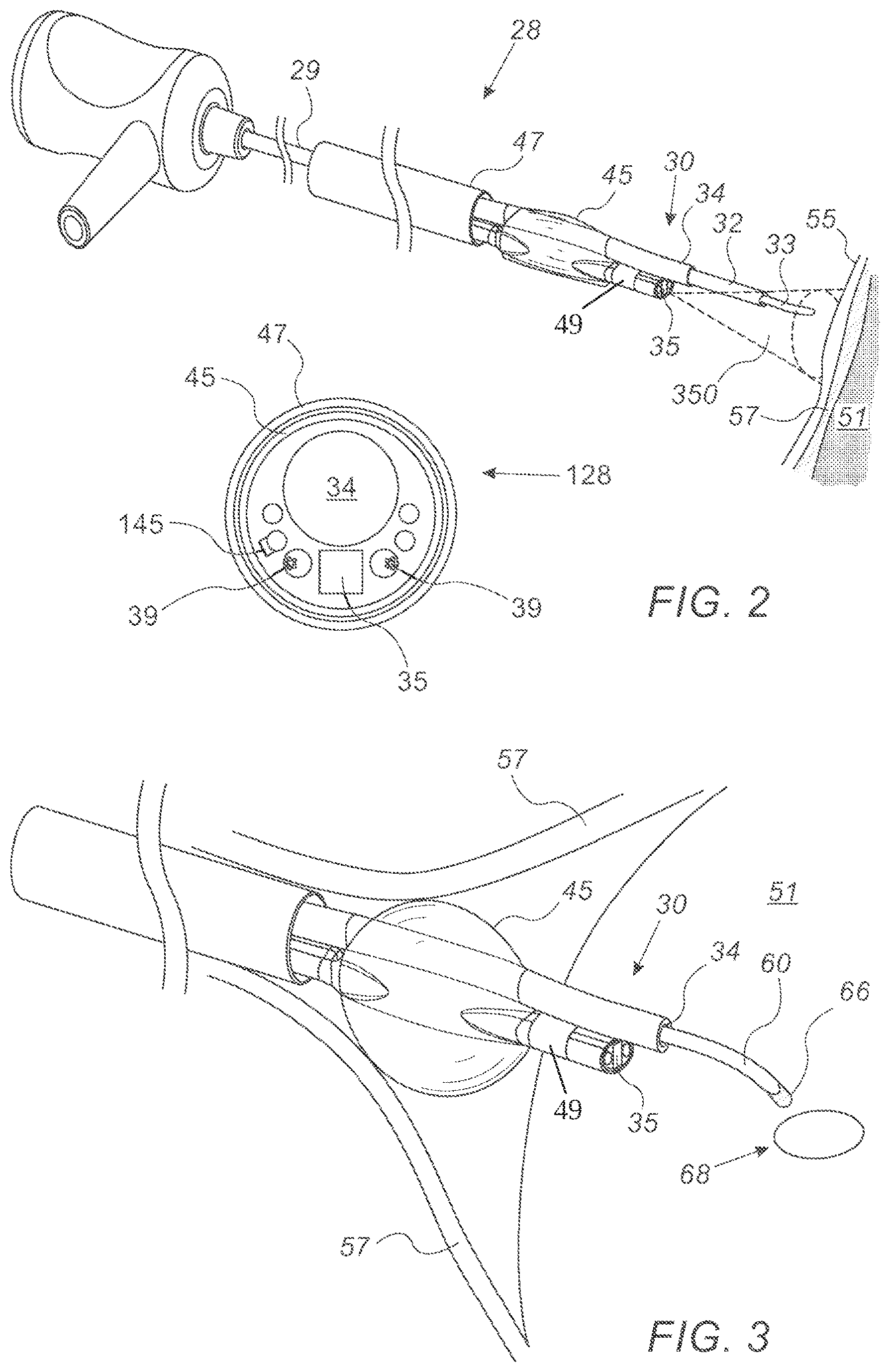 Patent US11779390 Figure 2 – Pericardium catheter including camera for guiding cutting through pericardium