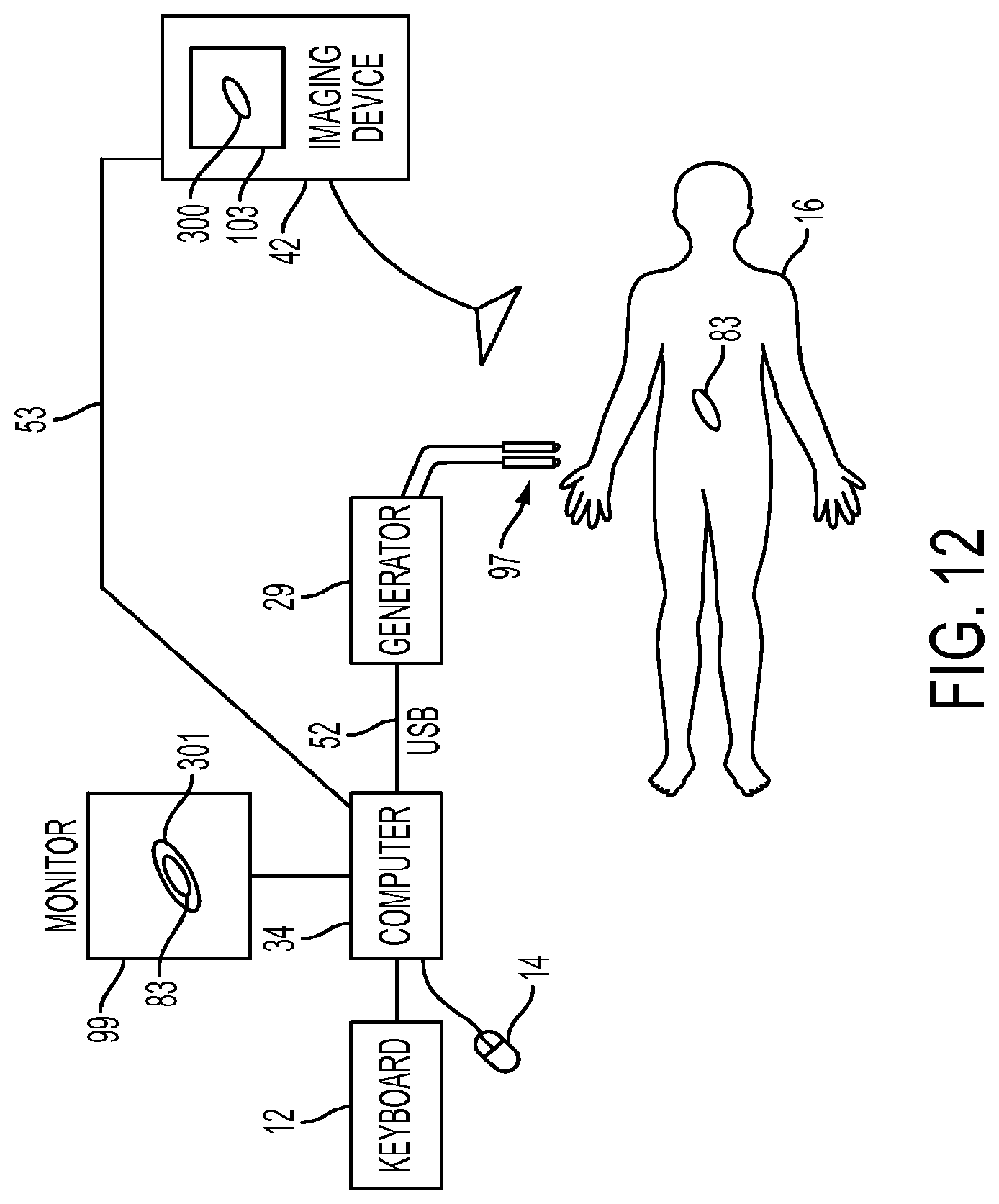 Patent US11779395 Figure 12 – Multiple treatment zone ablation probe