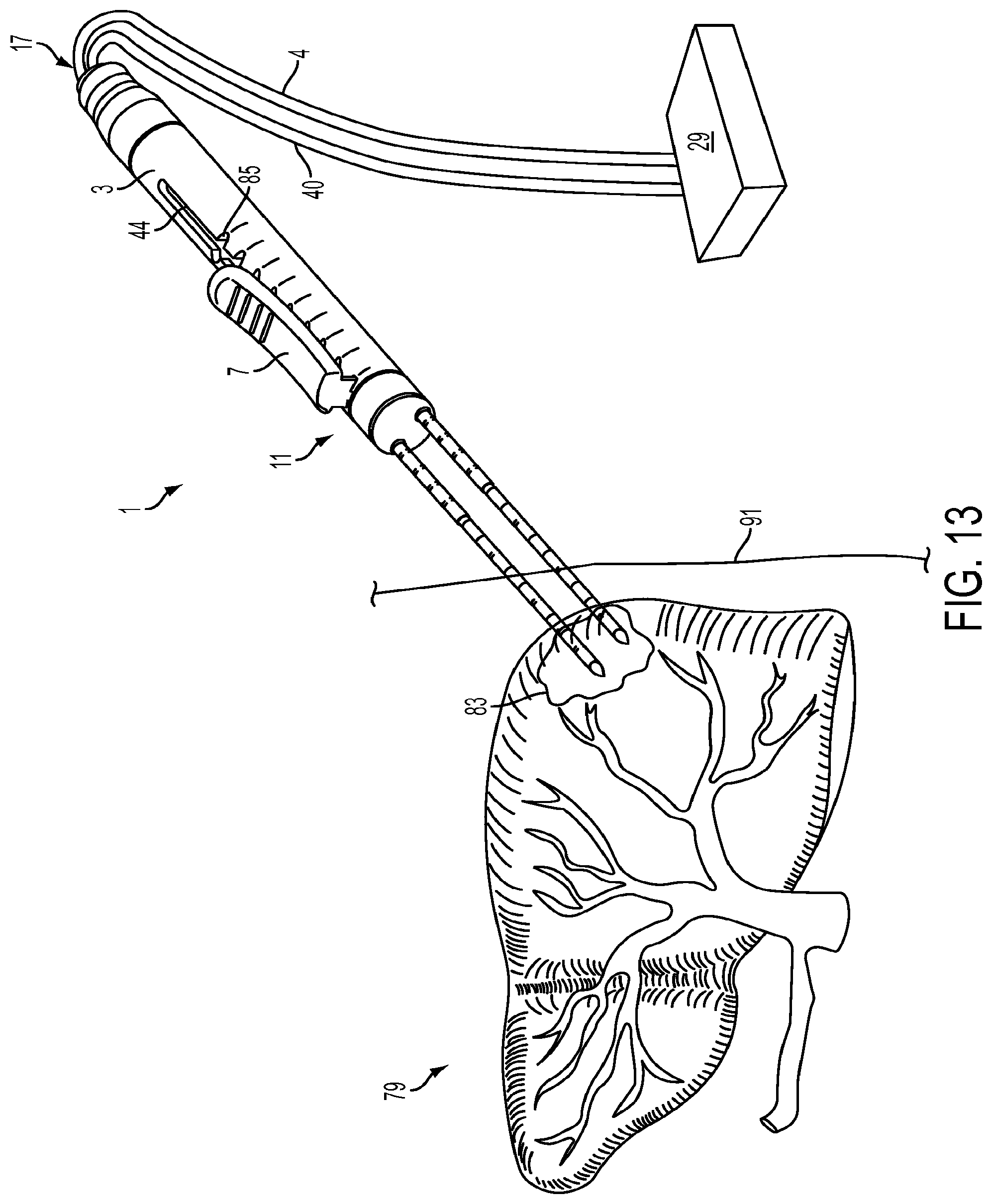 Patent US11779395 Figure 13 – Multiple treatment zone ablation probe