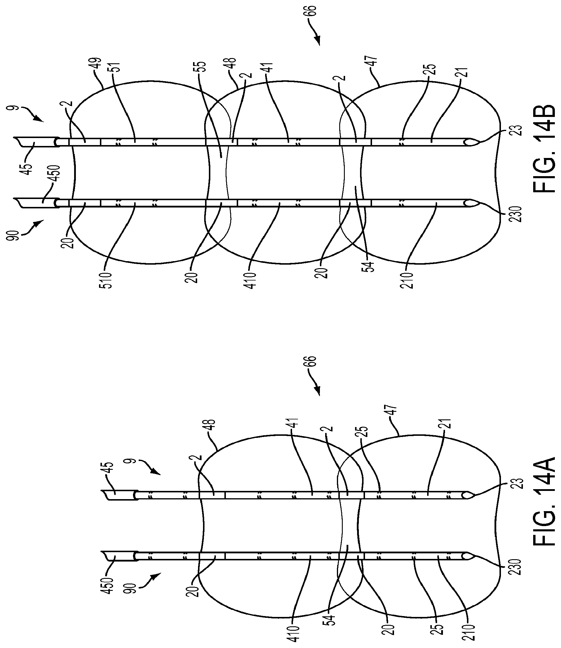 Patent US11779395 Figure 14 – Multiple treatment zone ablation probe