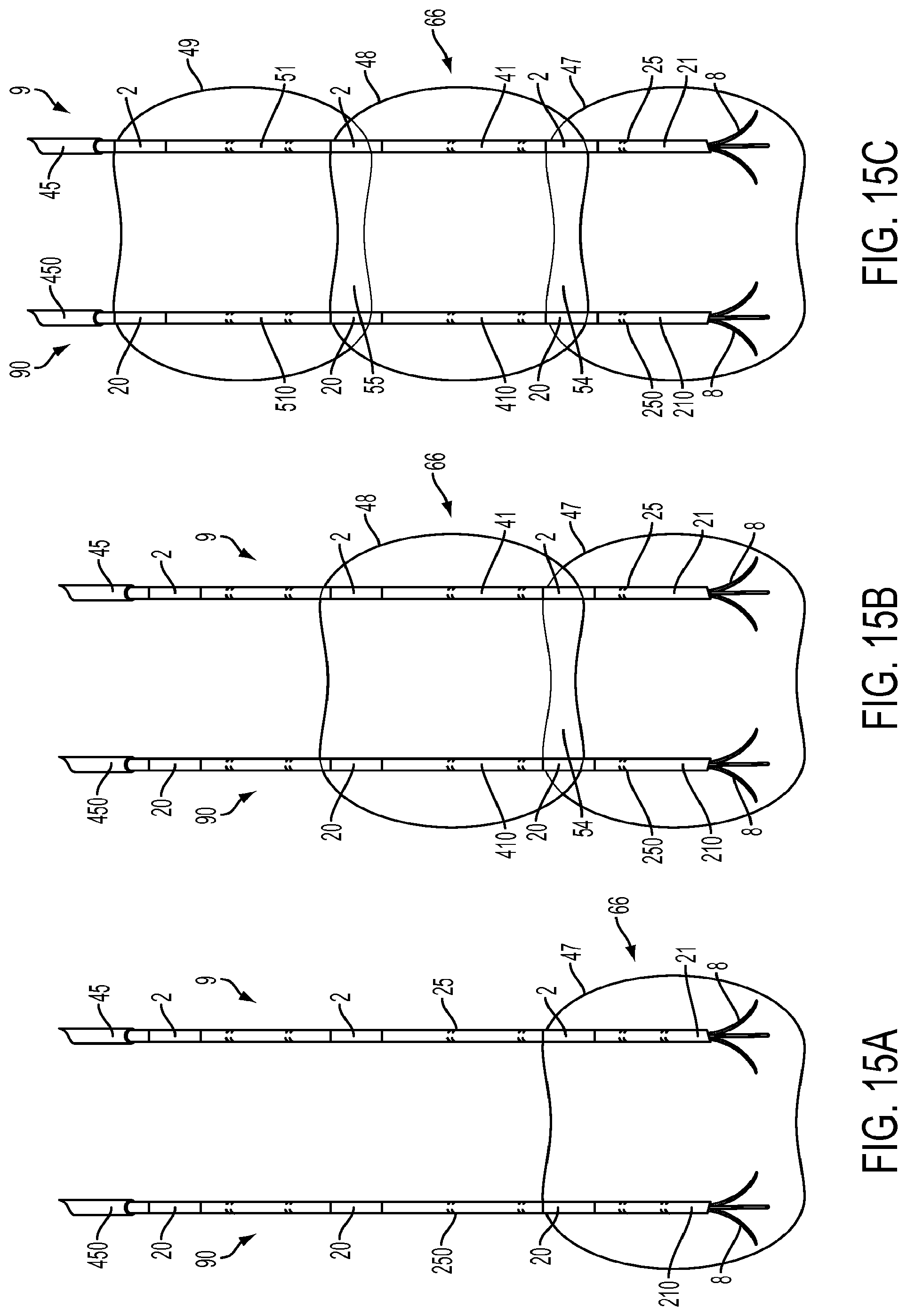 Patent US11779395 Figure 15 – Multiple treatment zone ablation probe
