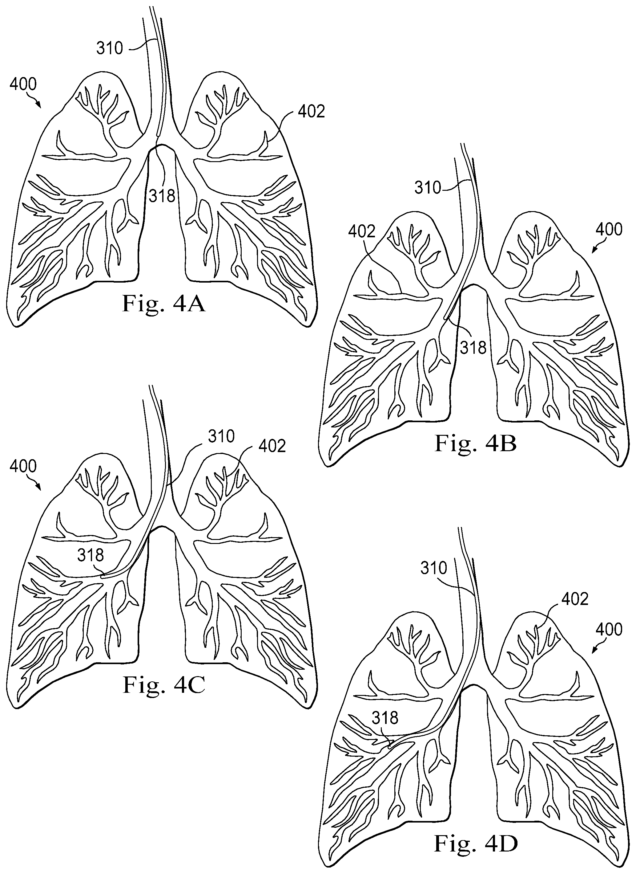 Patent US11779396 Figure 4 – Systems and methods for registering elongate devices to three dimensional images in image-guided procedures