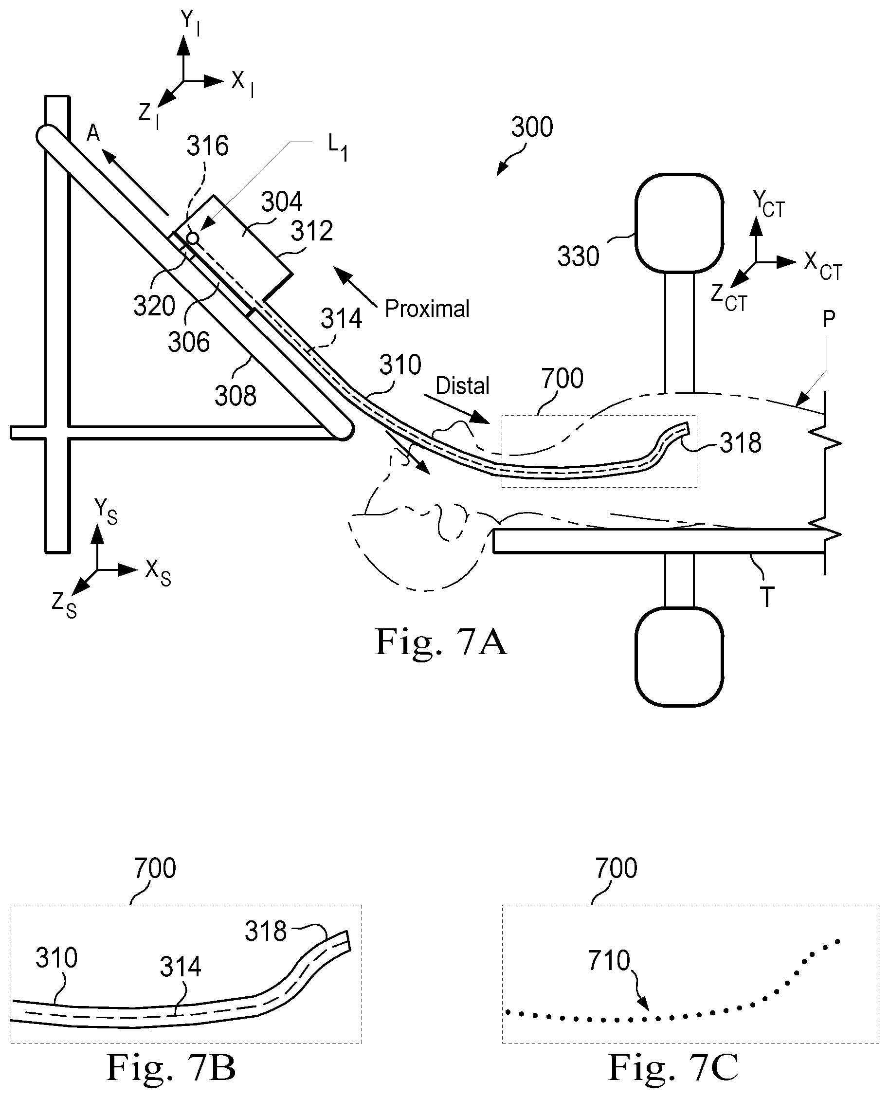 Patent US11779396 Figure 7 – Systems and methods for registering elongate devices to three dimensional images in image-guided procedures