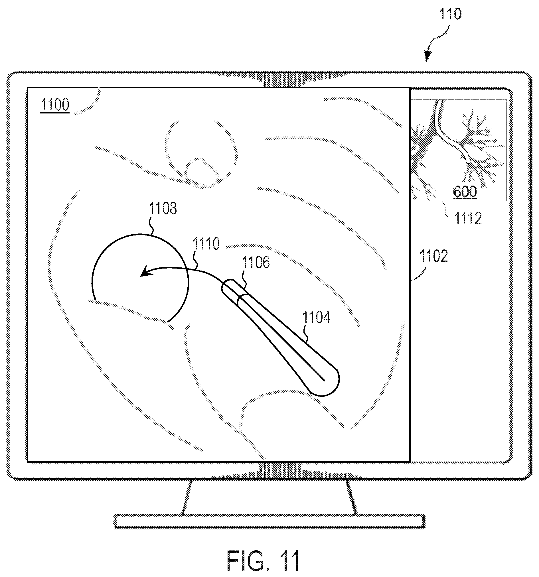 Patent US11779396 Figure 12 – Systems and methods for registering elongate devices to three dimensional images in image-guided procedures