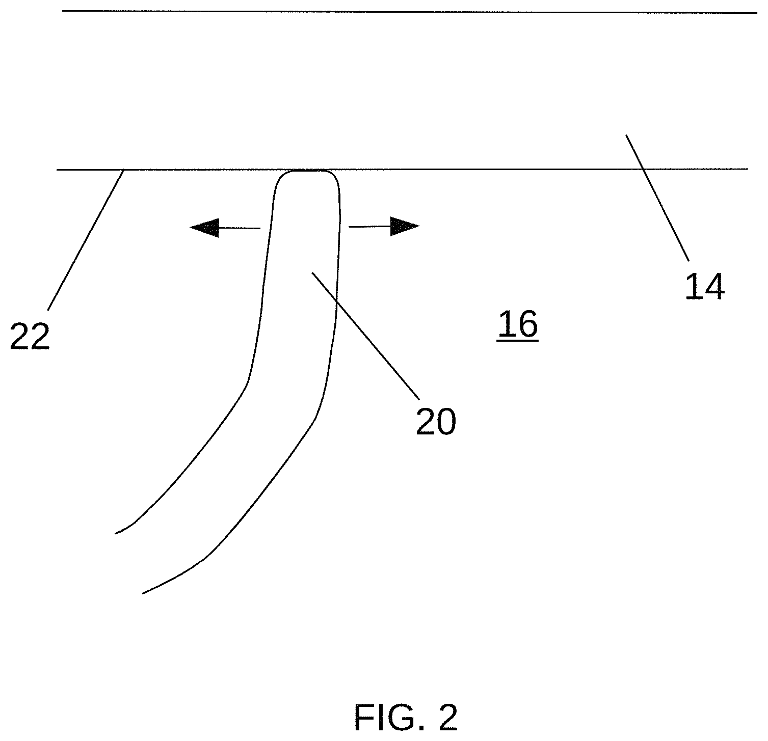 Patent US11779397 Figure 2 – Biological tissue position location and marking