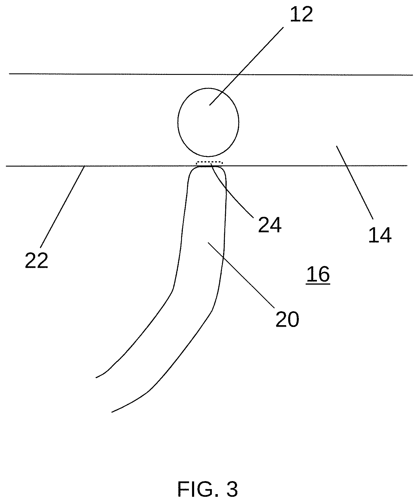 Patent US11779397 Figure 3 – Biological tissue position location and marking
