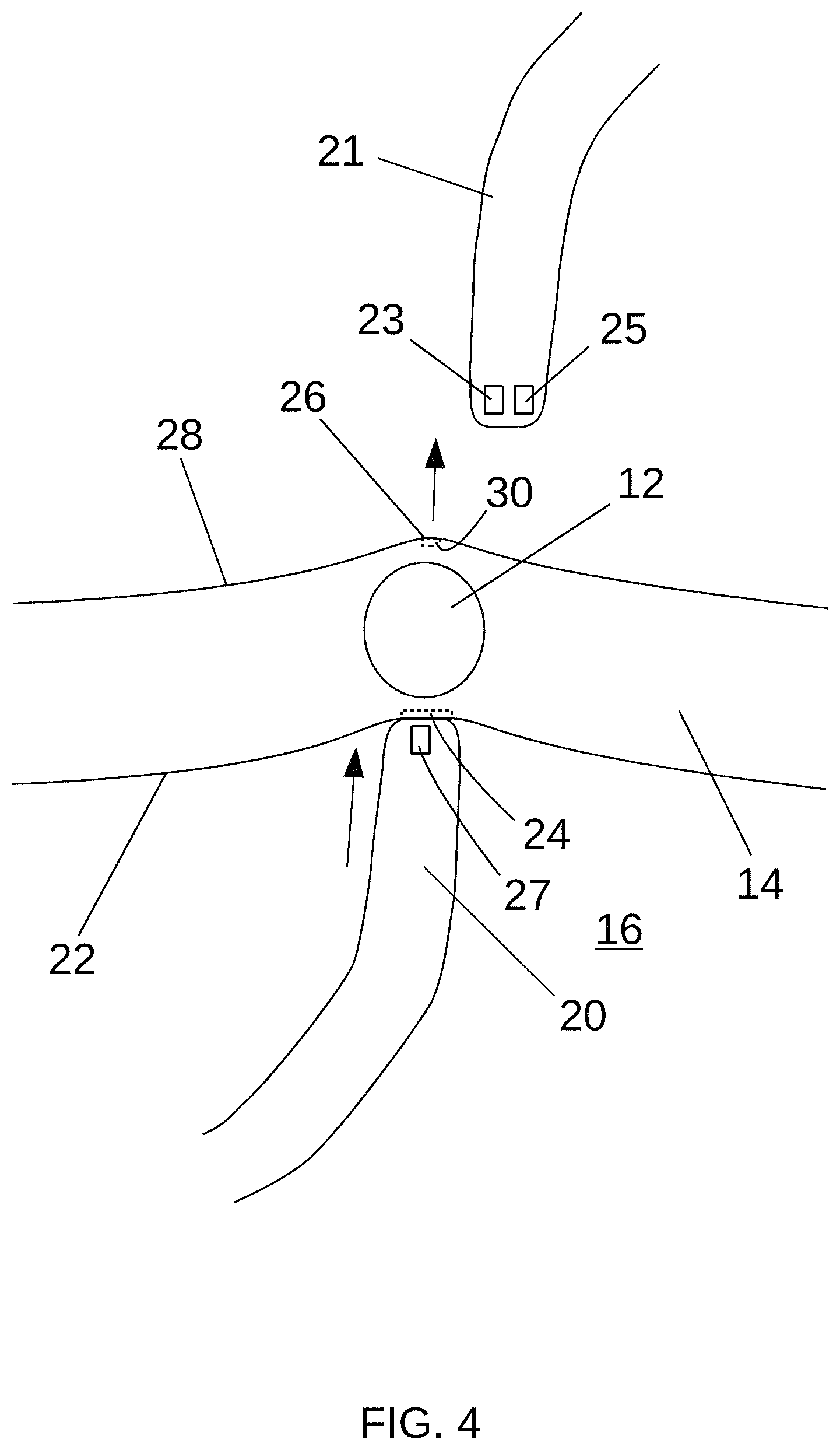 Patent US11779397 Figure 4 – Biological tissue position location and marking