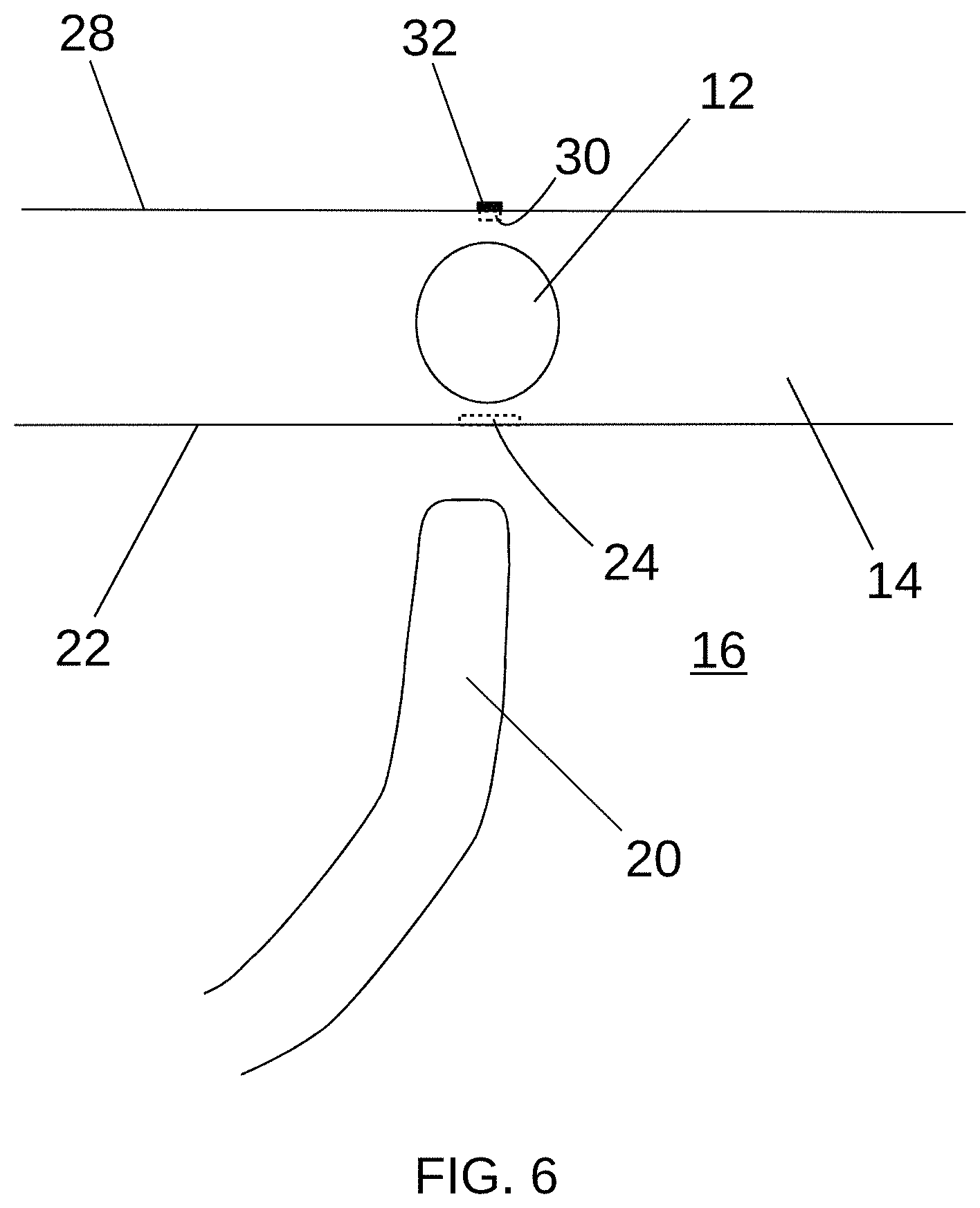 Patent US11779397 Figure 6 – Biological tissue position location and marking