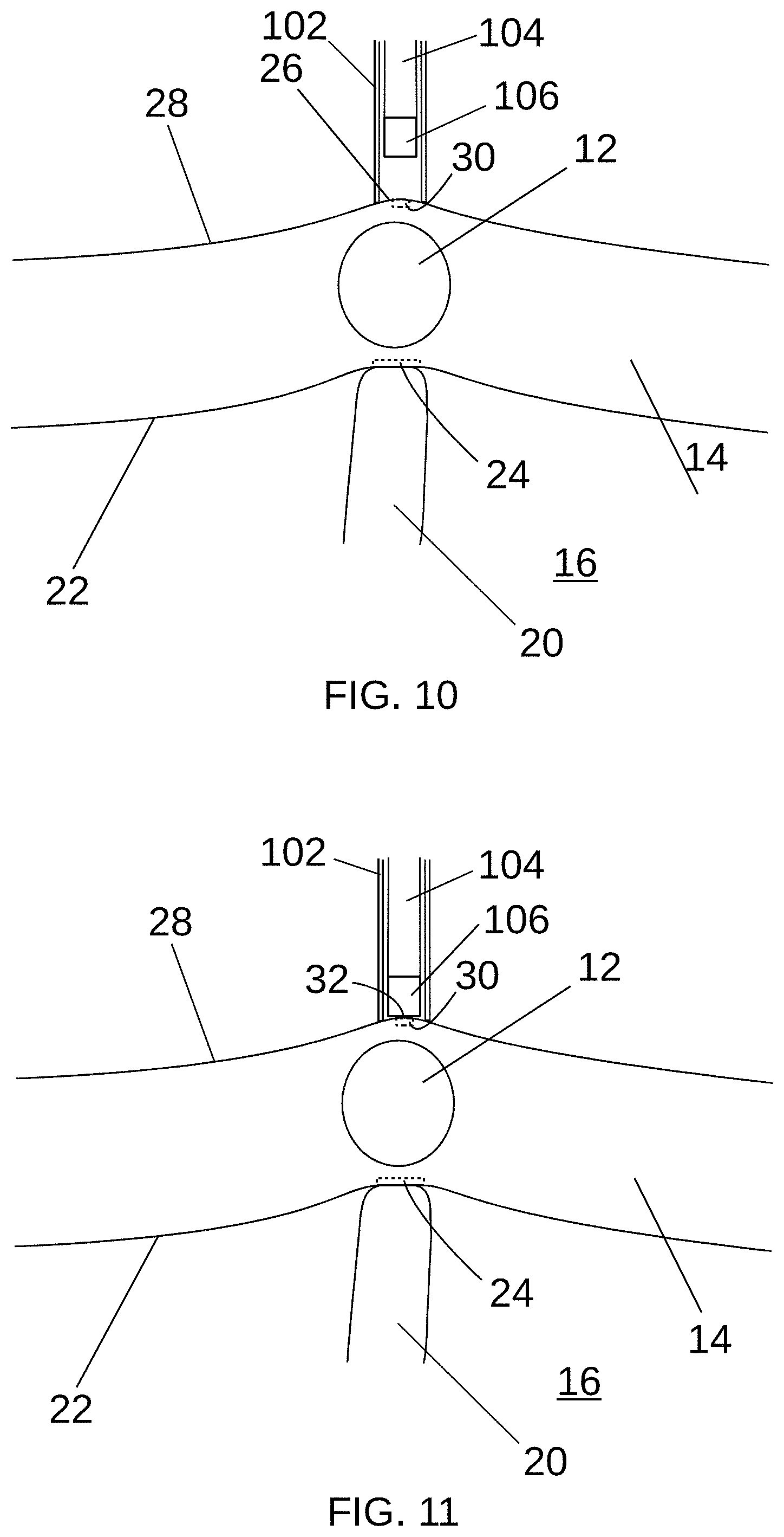 Patent US11779397 Figure 9 – Biological tissue position location and marking