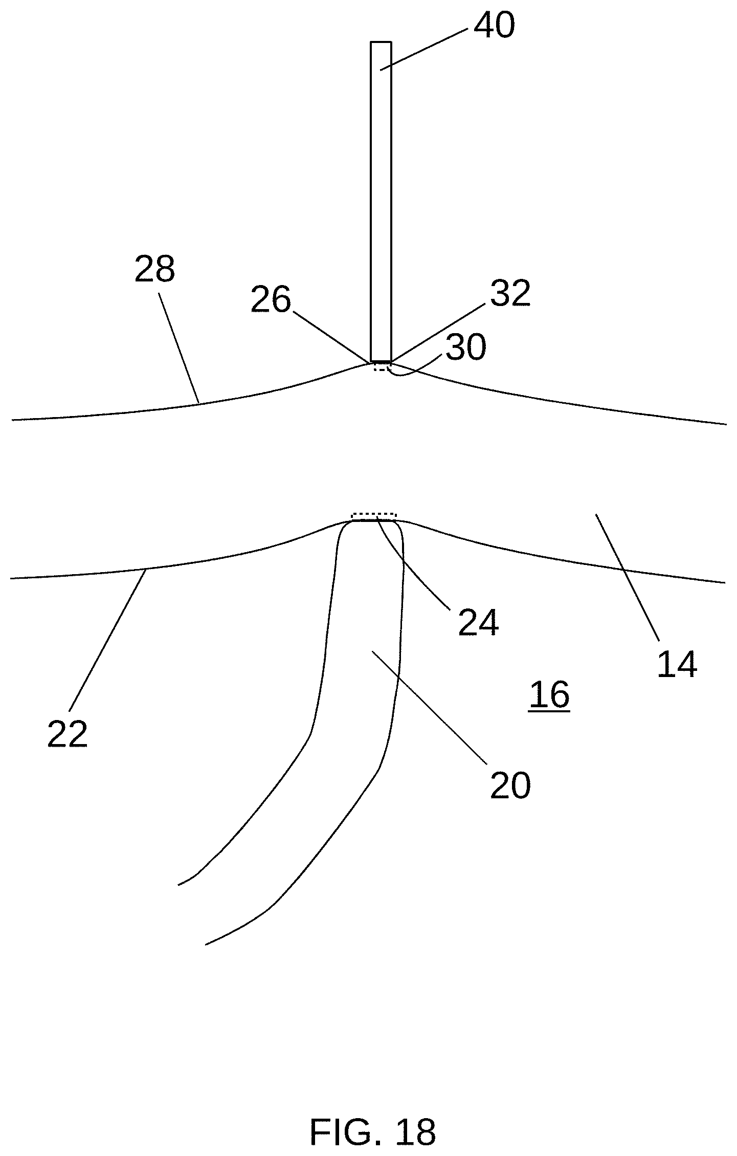 Patent US11779397 Figure 13 – Biological tissue position location and marking