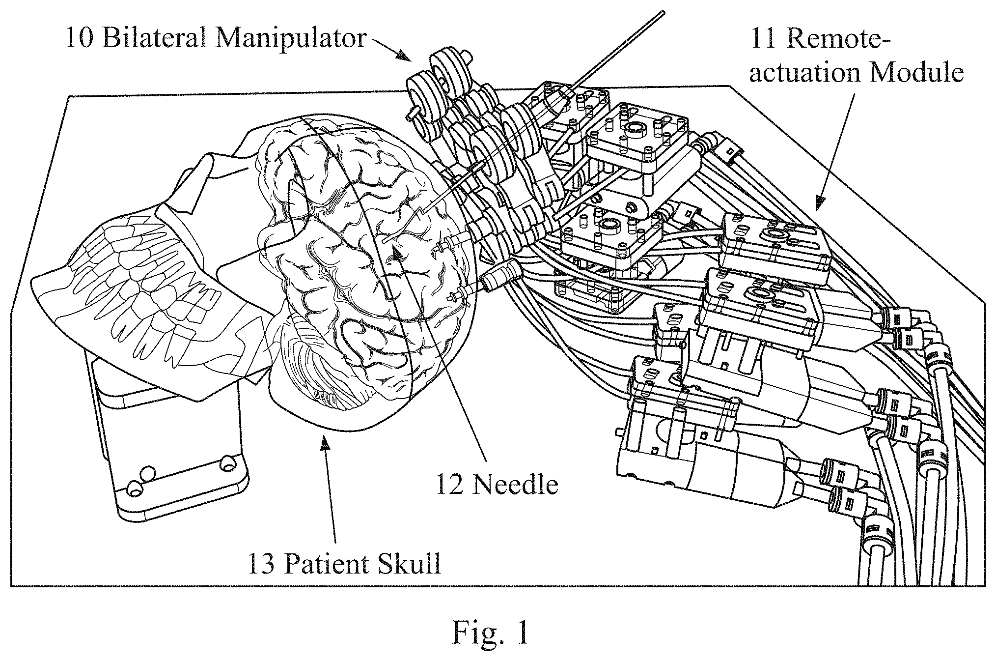 Patent US11779398 Figure 1 – Robotic stereotactic system for MRI-guided neurosurgery