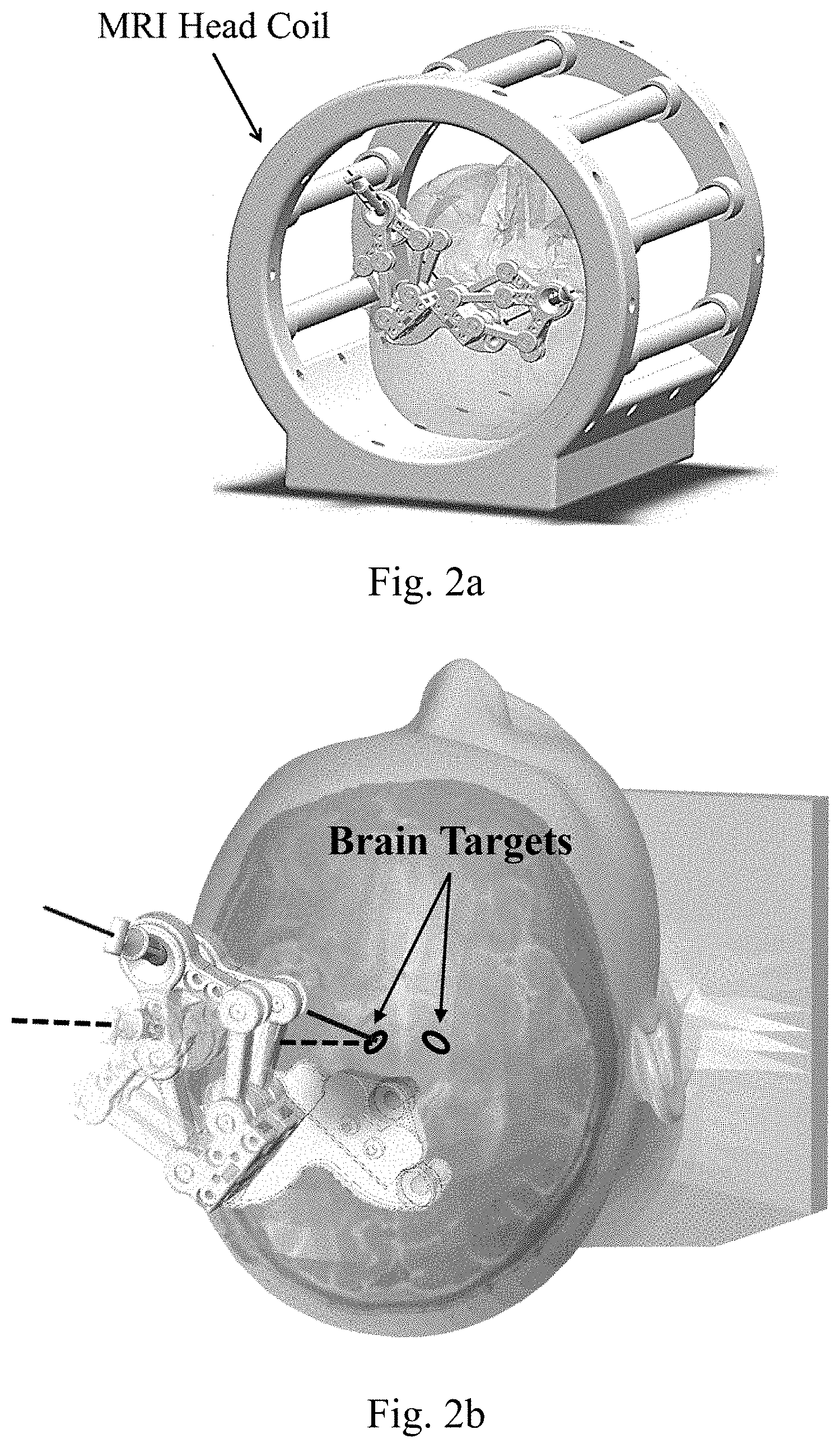 Patent US11779398 Figure 2 – Robotic stereotactic system for MRI-guided neurosurgery
