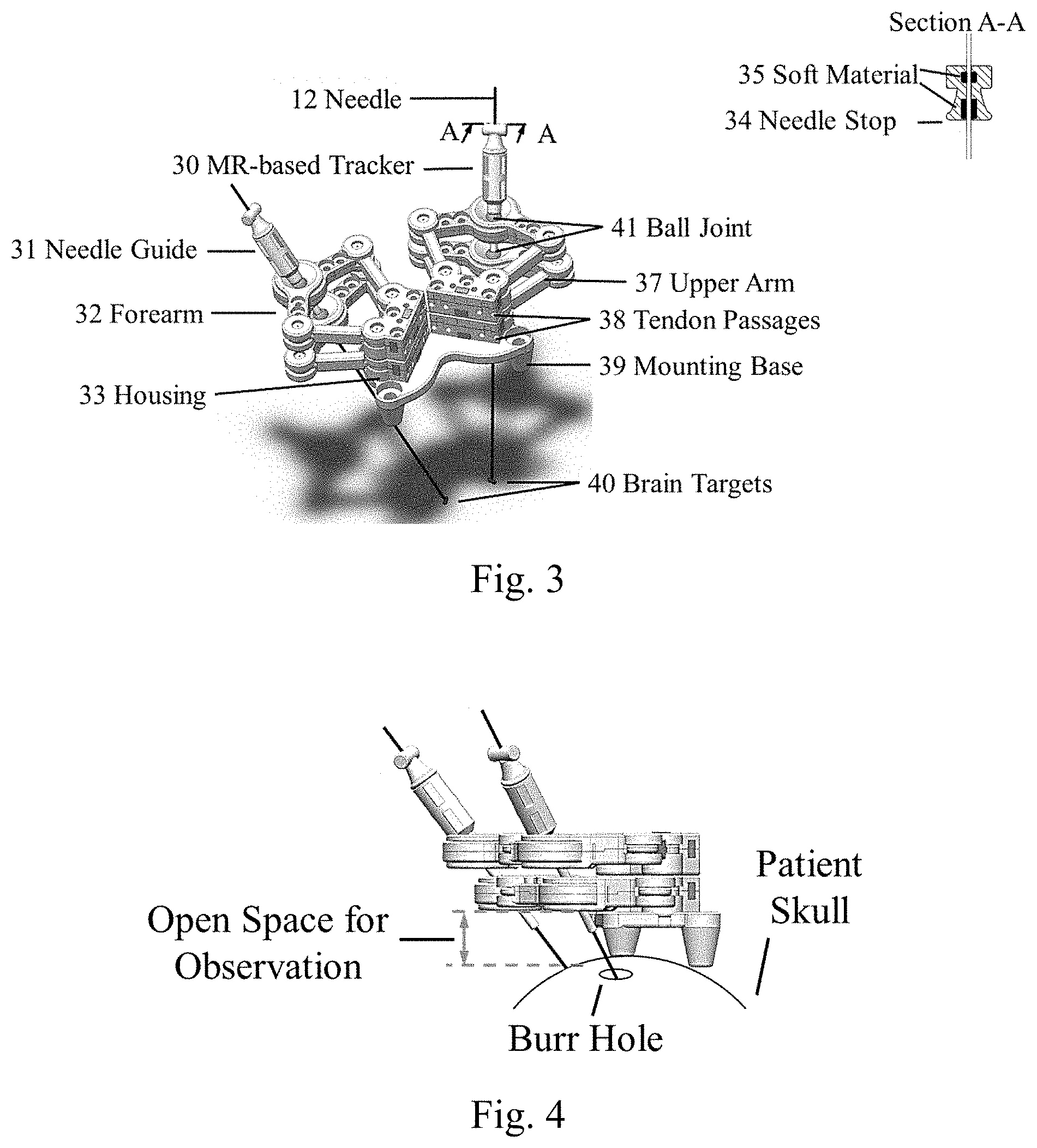 Patent US11779398 Figure 3 – Robotic stereotactic system for MRI-guided neurosurgery