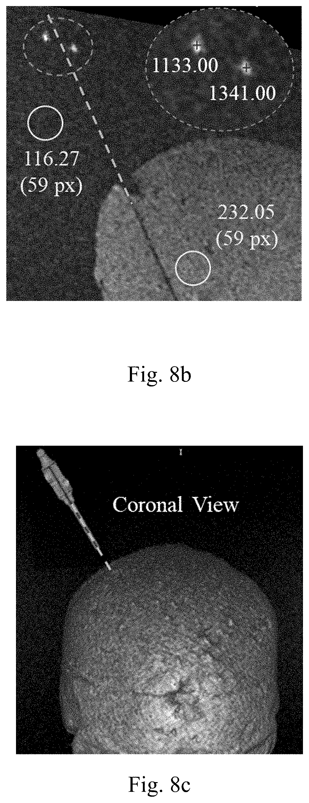 Patent US11779398 Figure 7 – Robotic stereotactic system for MRI-guided neurosurgery
