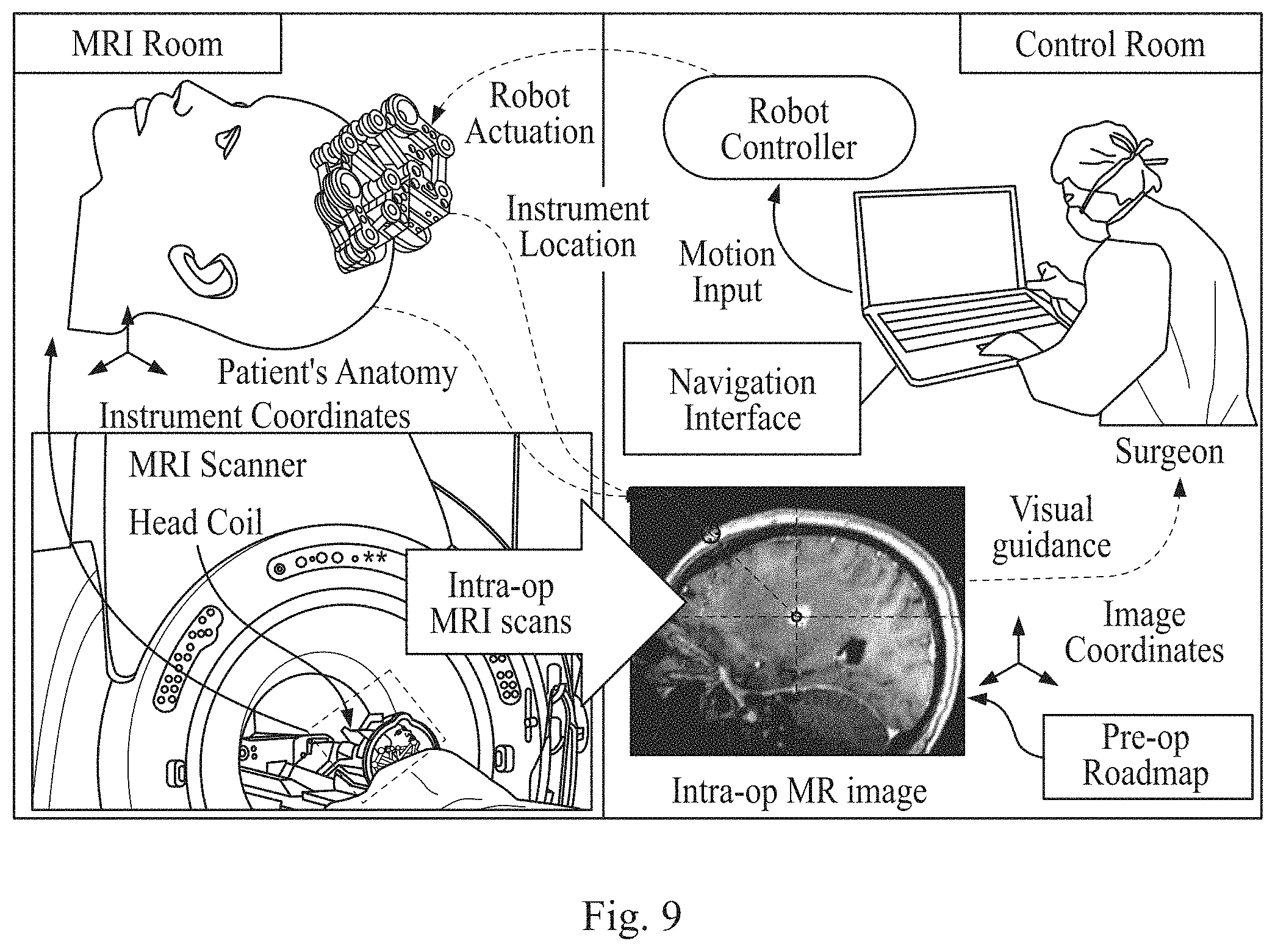 Patent US11779398 Figure 8 – Robotic stereotactic system for MRI-guided neurosurgery