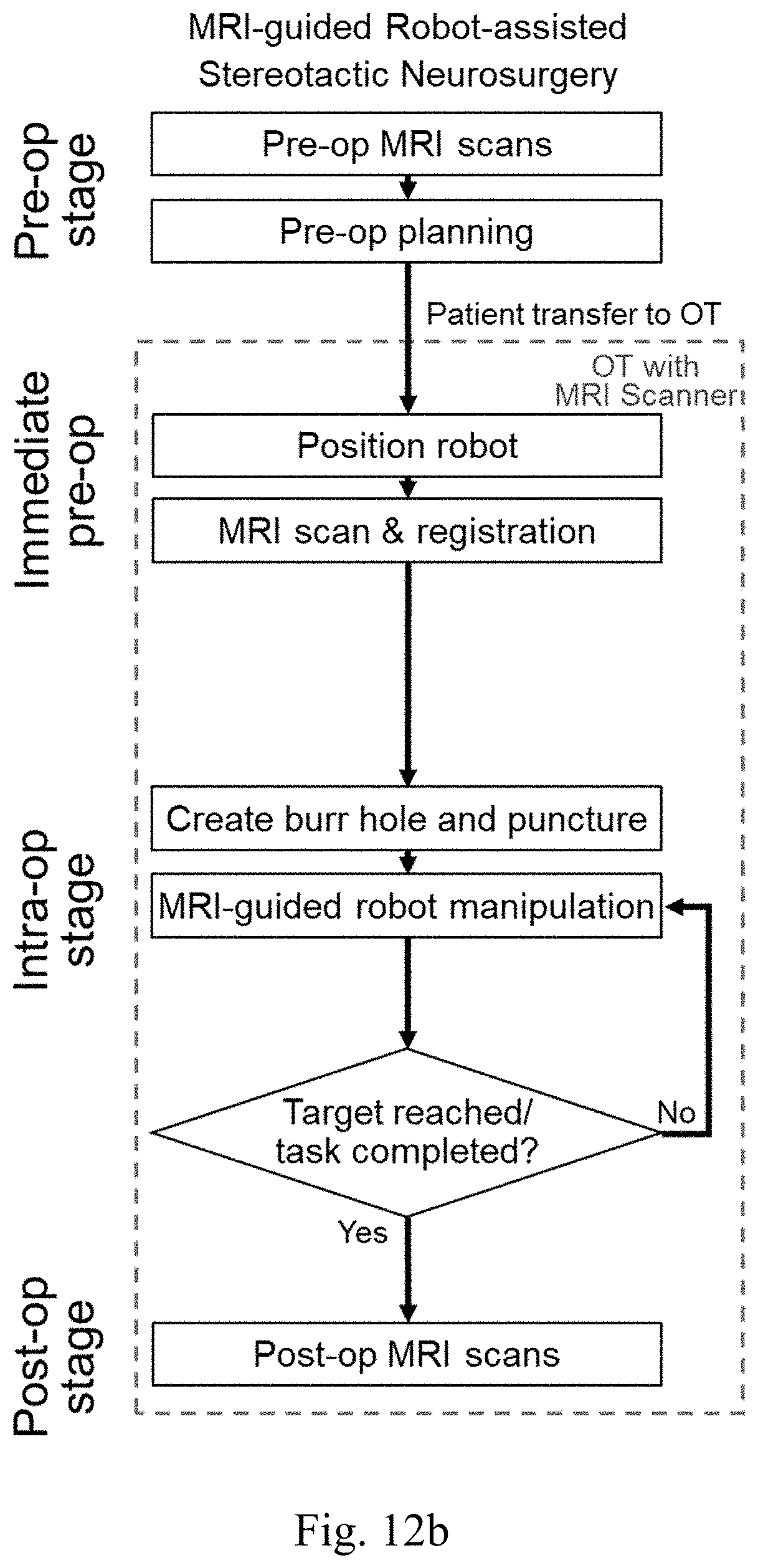 Patent US11779398 Figure 11 – Robotic stereotactic system for MRI-guided neurosurgery