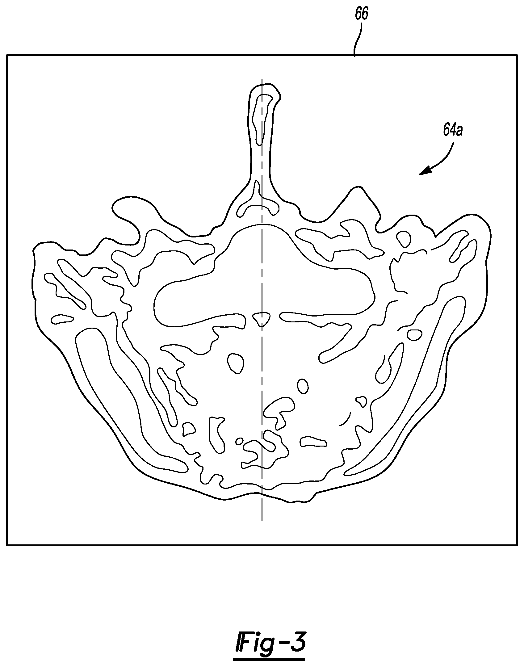 Patent US11779399 Figure 3 – Method and apparatus for image-based navigation