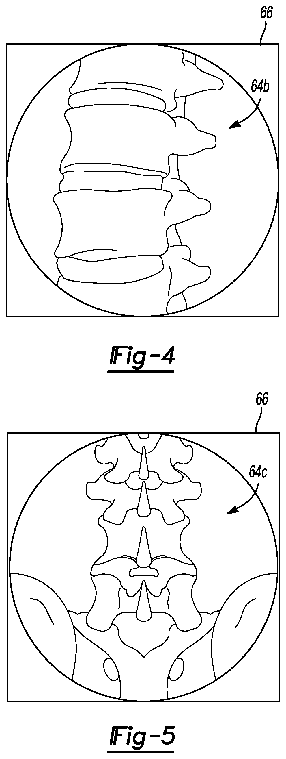 Patent US11779399 Figure 4 – Method and apparatus for image-based navigation