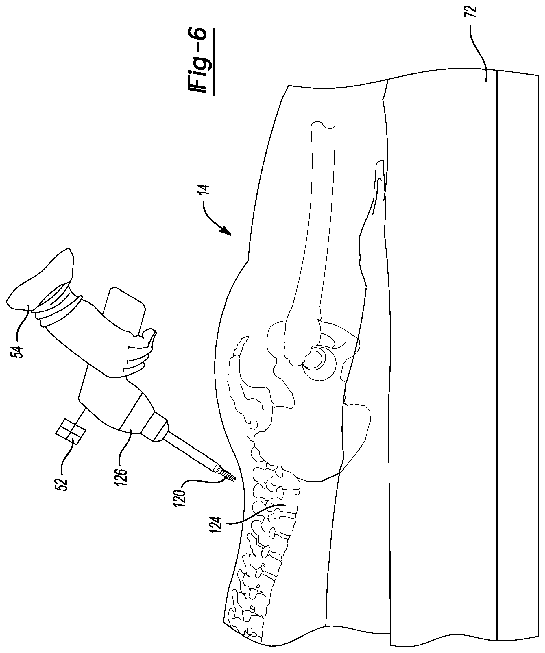 Patent US11779399 Figure 5 – Method and apparatus for image-based navigation