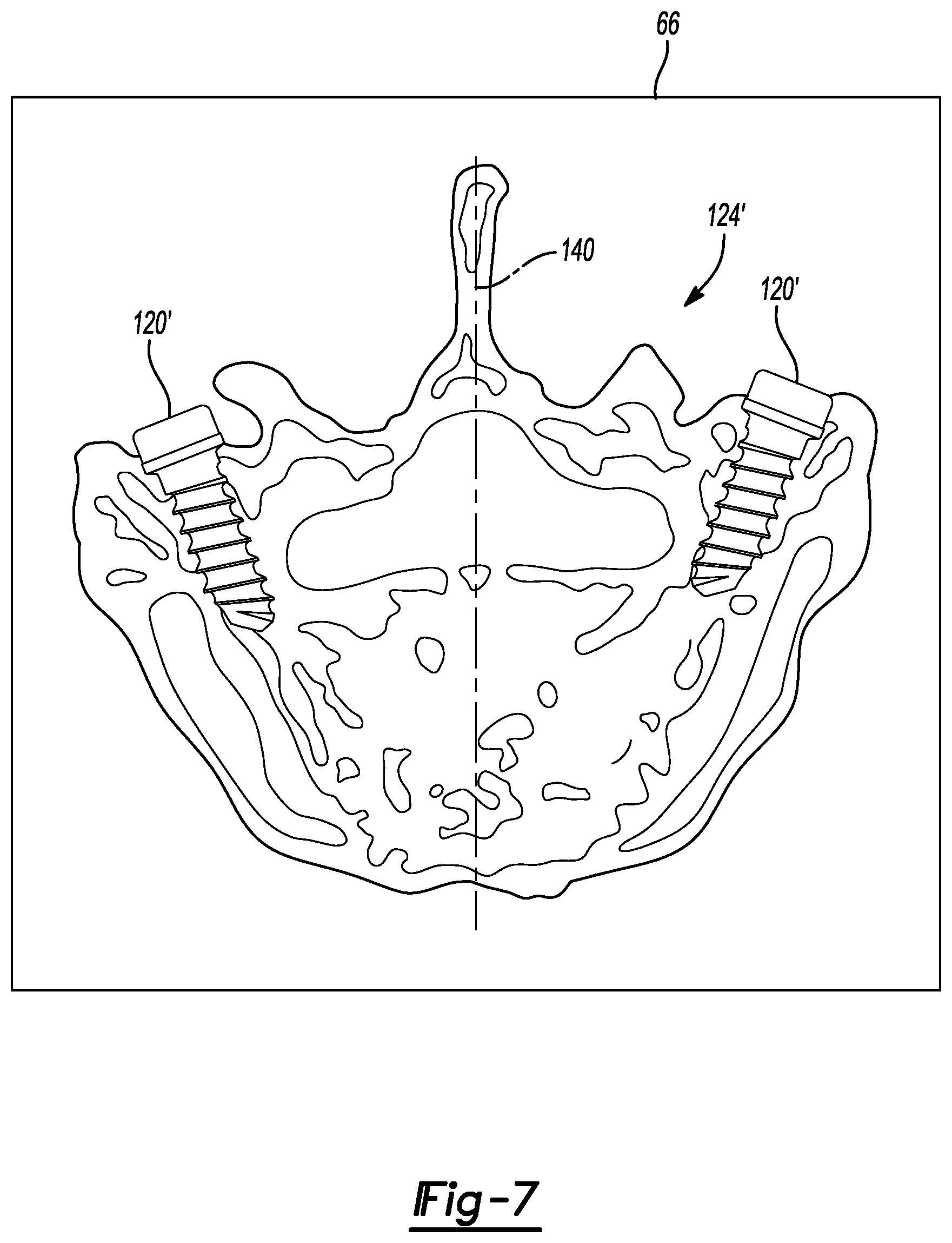 Patent US11779399 Figure 6 – Method and apparatus for image-based navigation