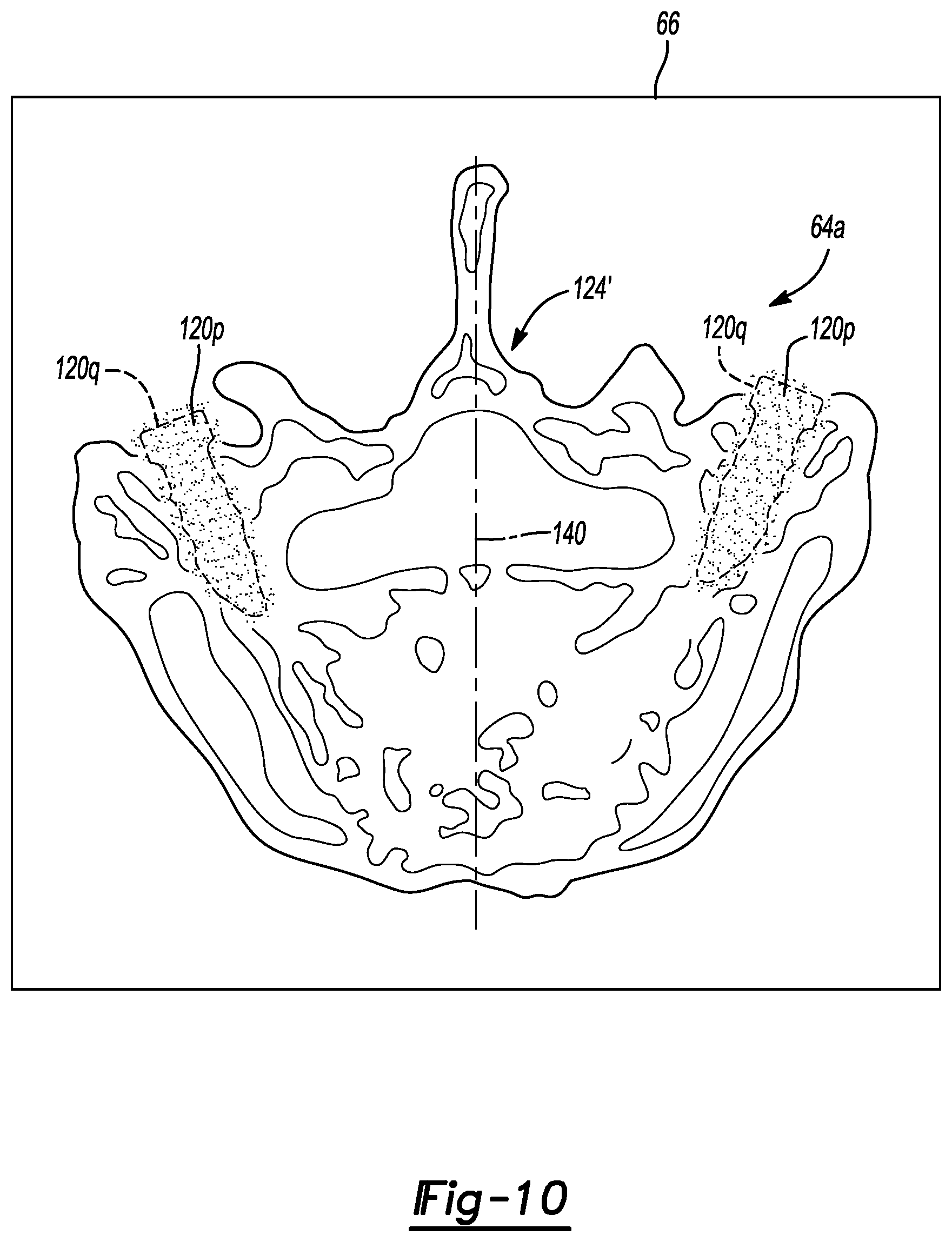Patent US11779399 Figure 8 – Method and apparatus for image-based navigation