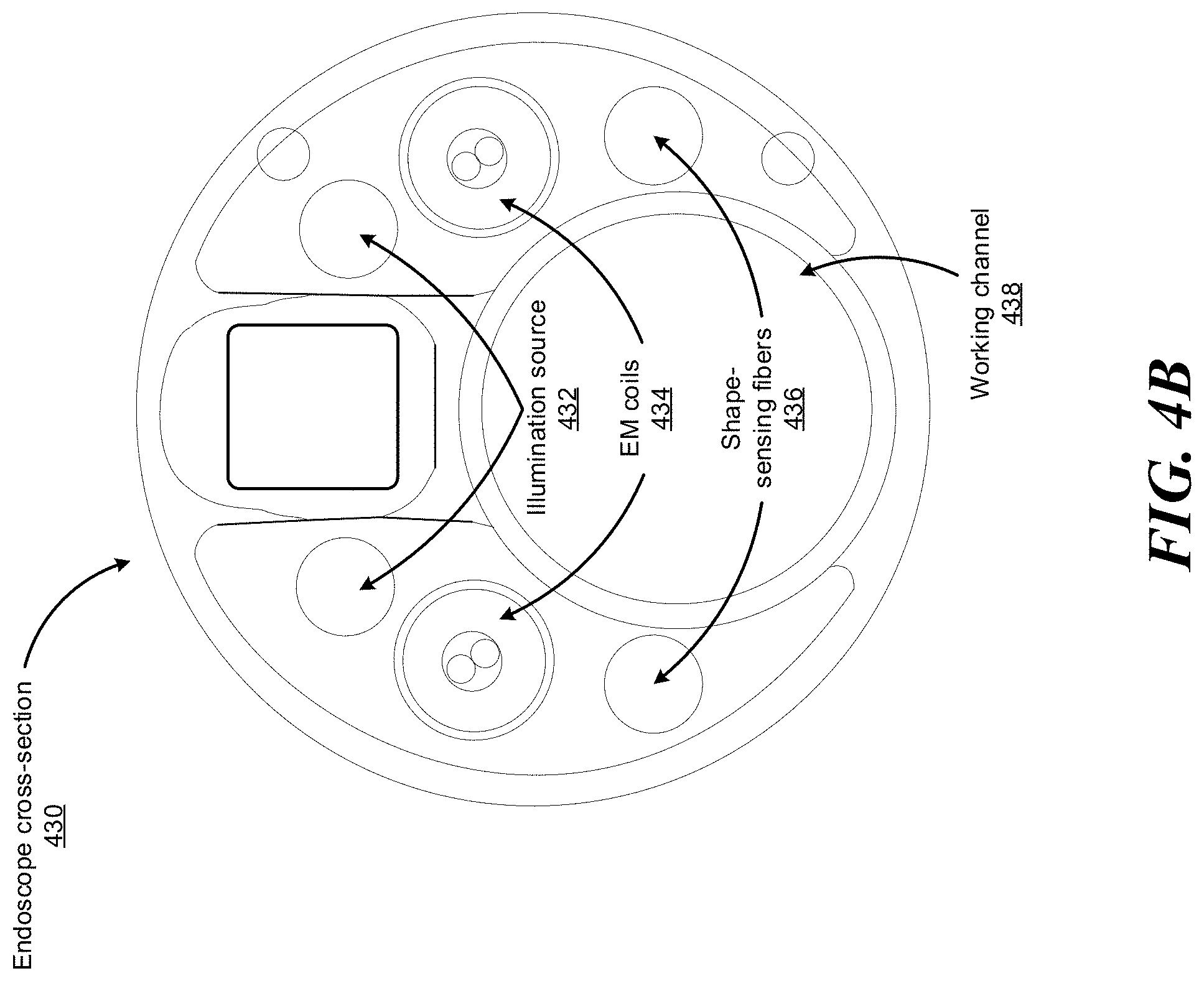 Patent US11779400 Figure 11 – Combining strain-based shape sensing with catheter control