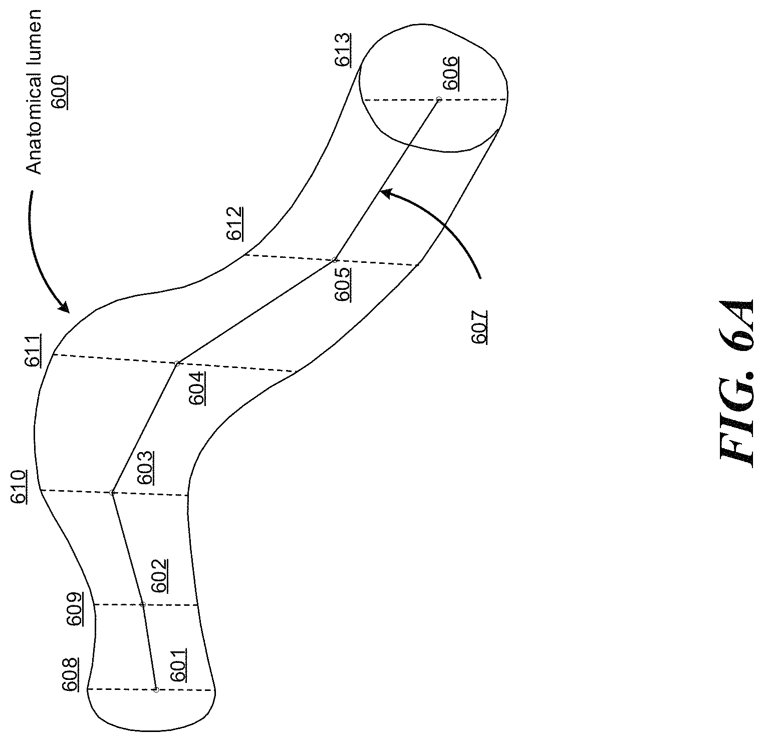Patent US11779400 Figure 16 – Combining strain-based shape sensing with catheter control
