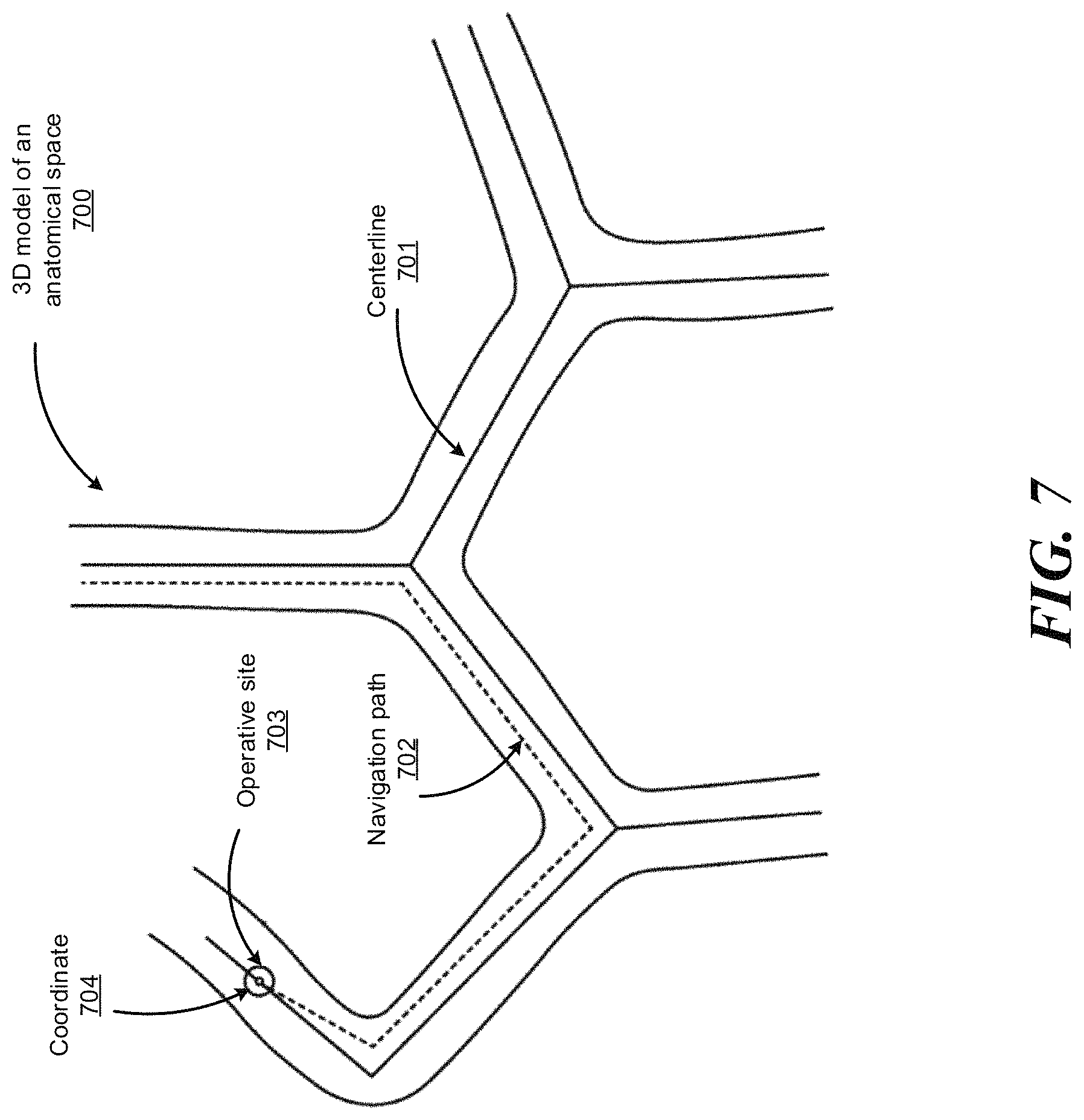 Patent US11779400 Figure 18 – Combining strain-based shape sensing with catheter control