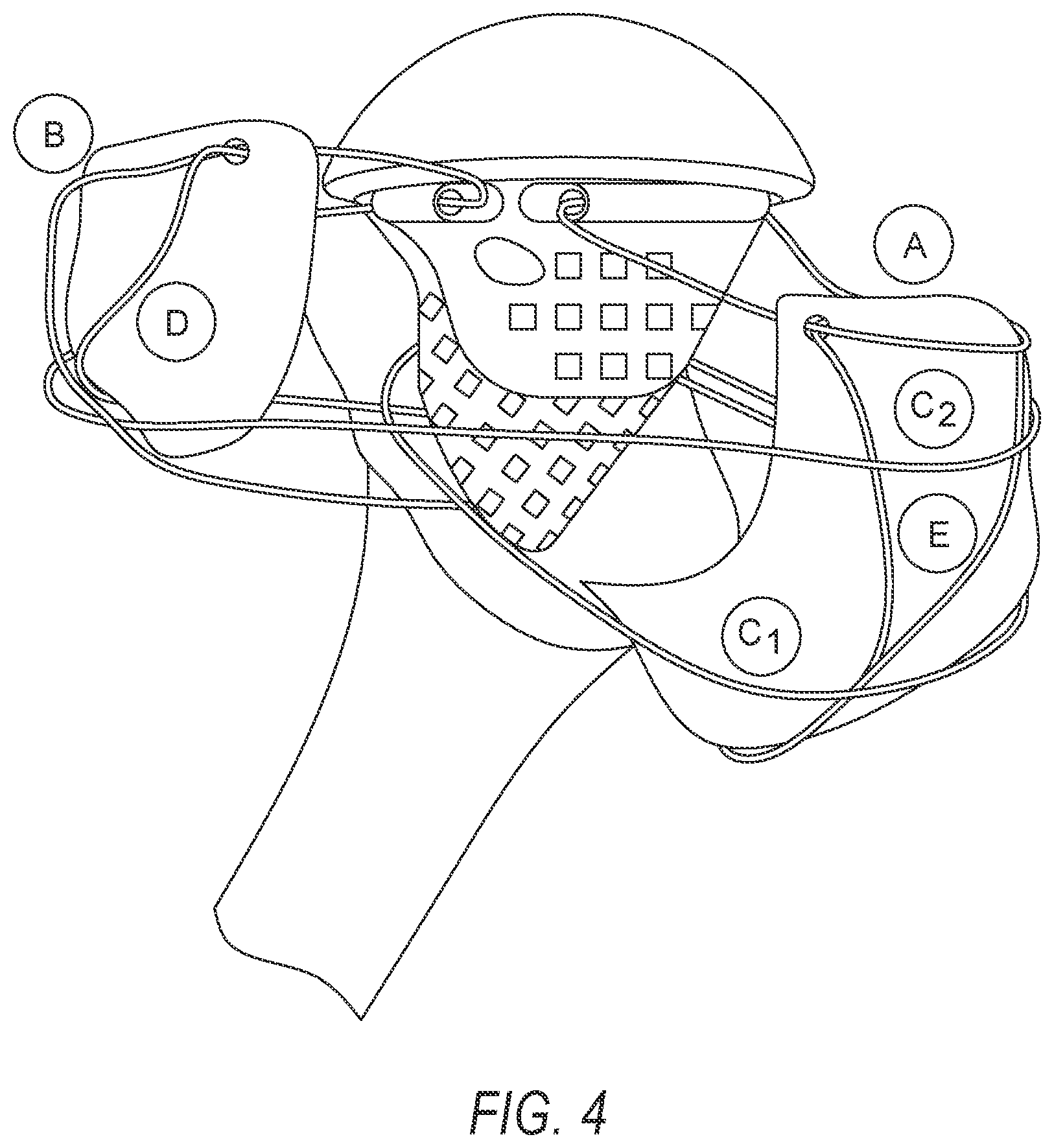 Patent US11779402 Figure 4 – Robotic shoulder repair and reconstruction