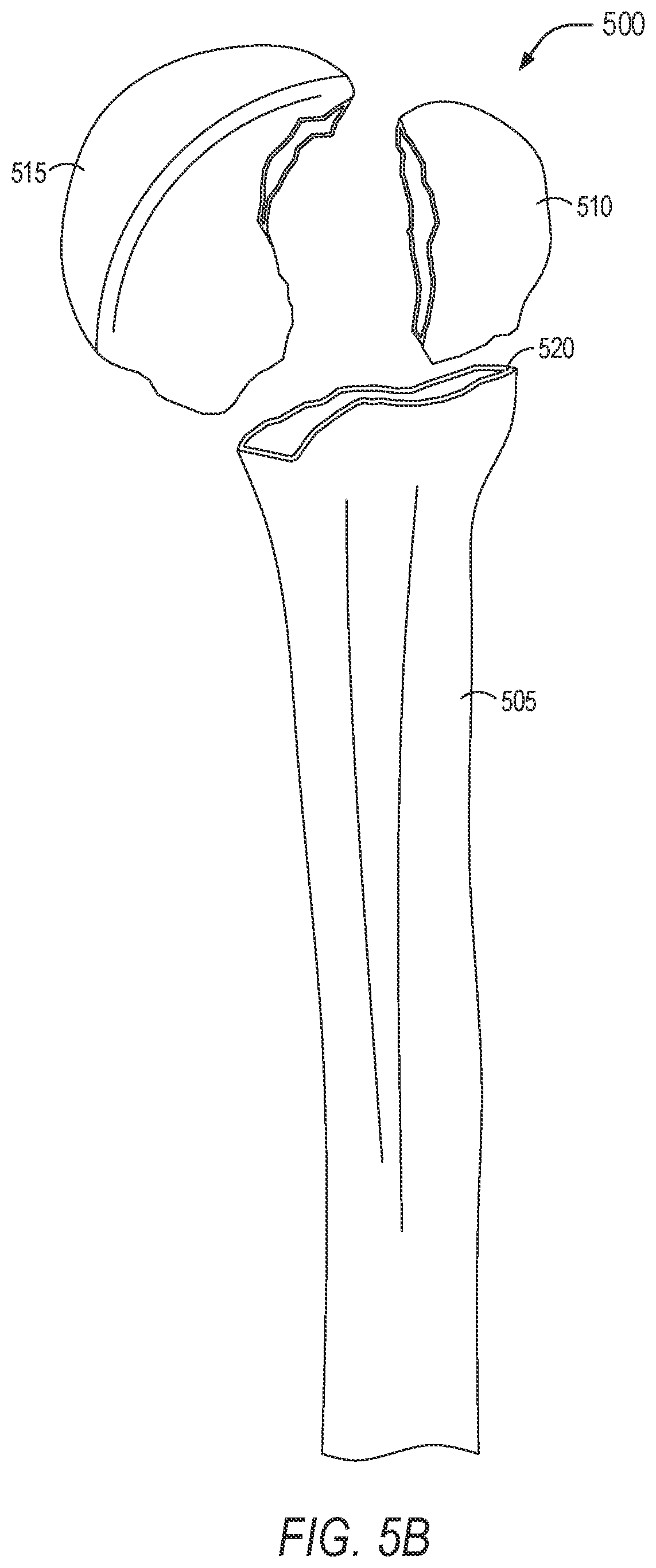 Patent US11779402 Figure 6 – Robotic shoulder repair and reconstruction
