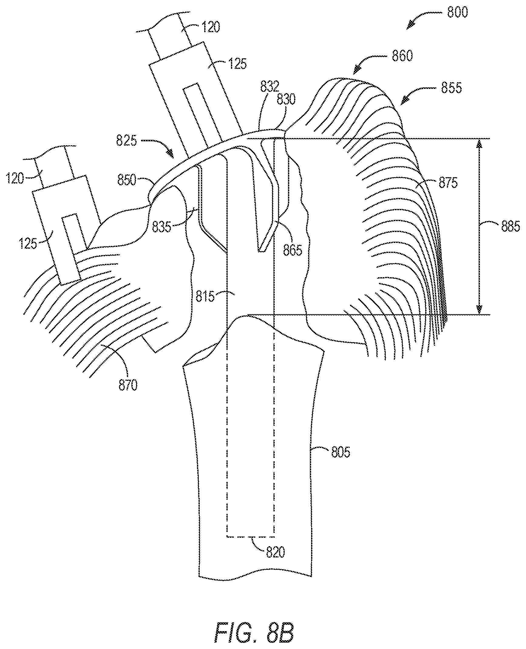 Patent US11779402 Figure 11 – Robotic shoulder repair and reconstruction
