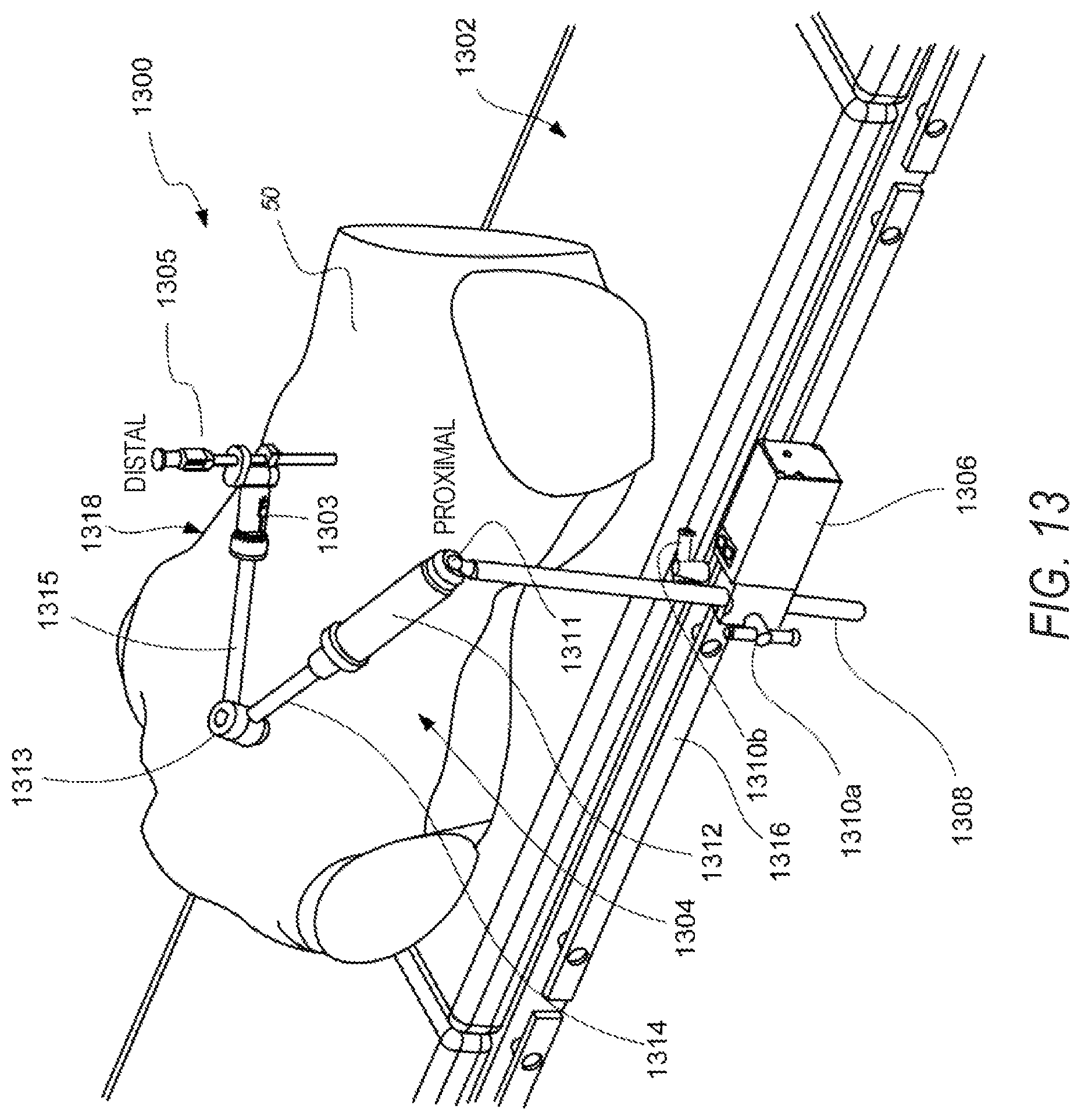 Patent US11779402 Figure 15 – Robotic shoulder repair and reconstruction