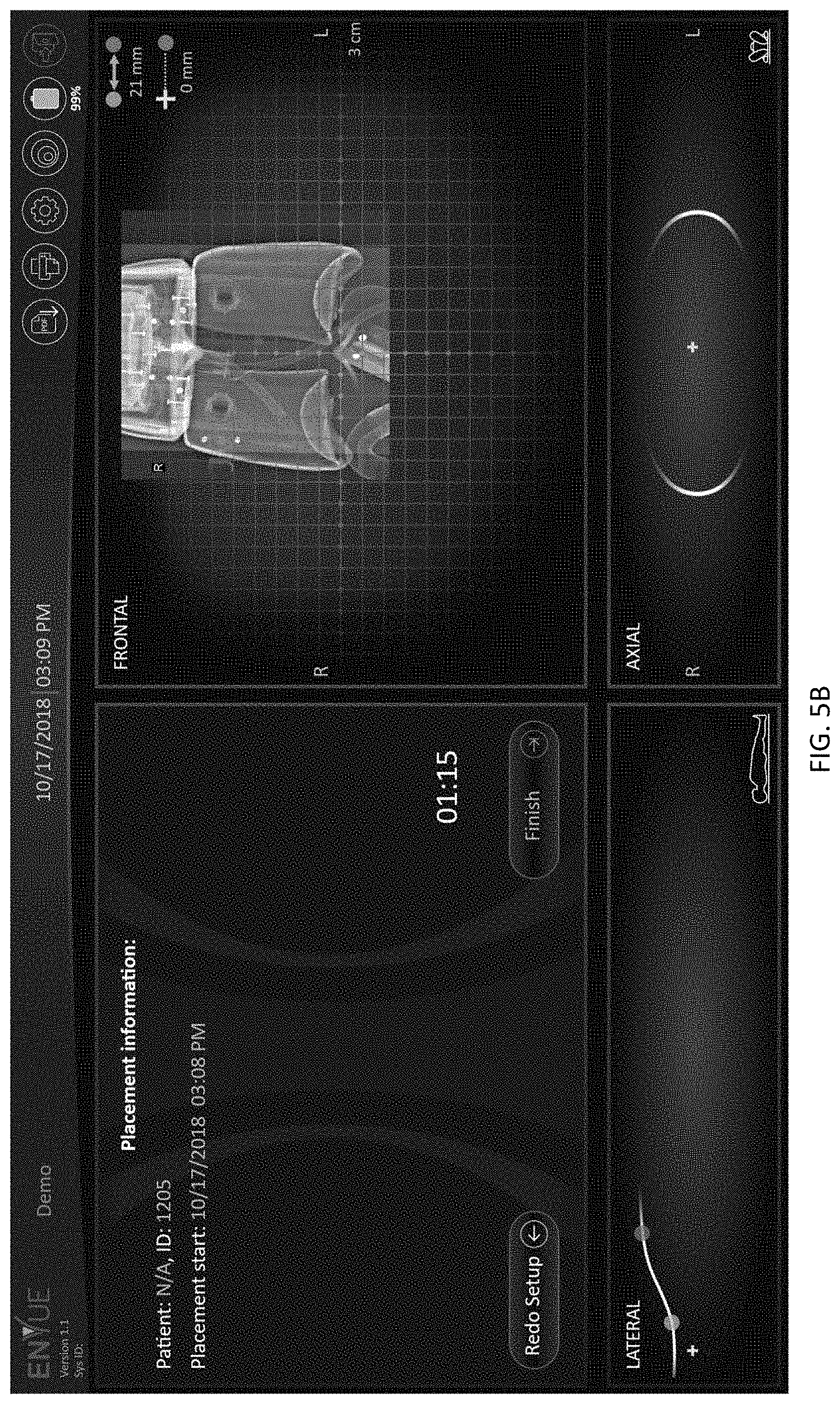 Patent US11779403 Figure 12 – Insertion device positioning guidance system and method