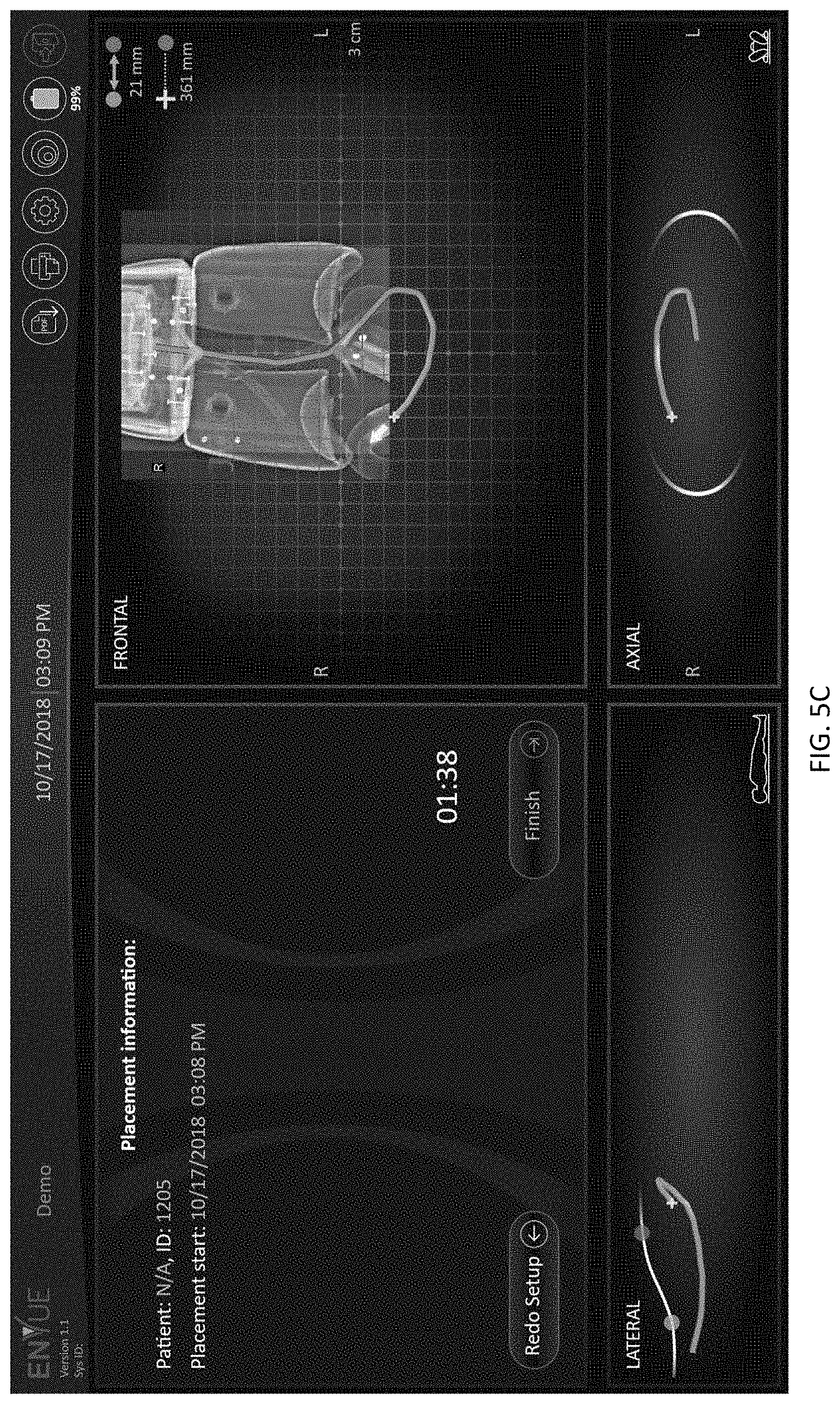 Patent US11779403 Figure 13 – Insertion device positioning guidance system and method