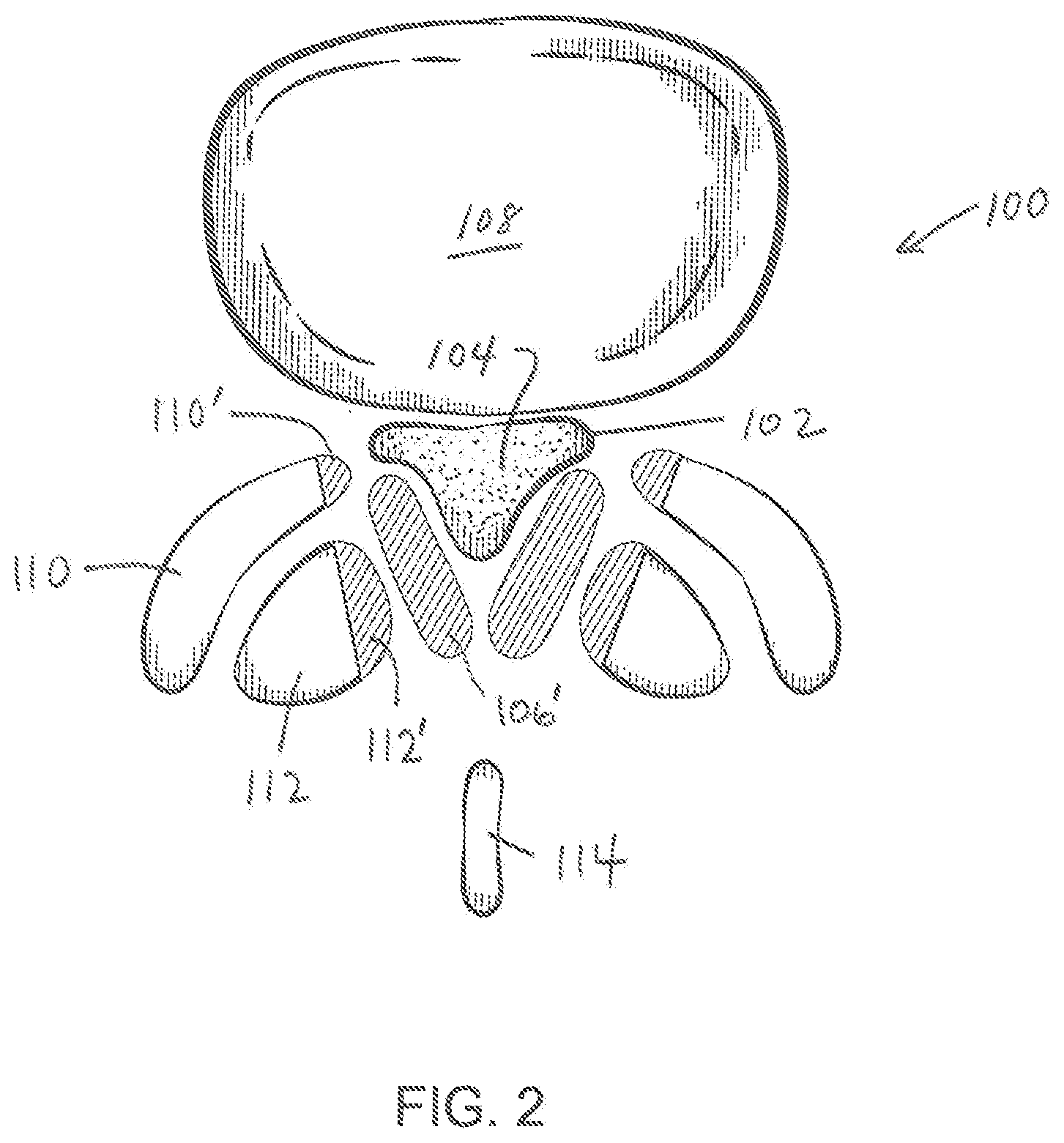 Patent US11779404 Figure 2 – Instrumentation and surgical method for image-guided microendoscopic decompression