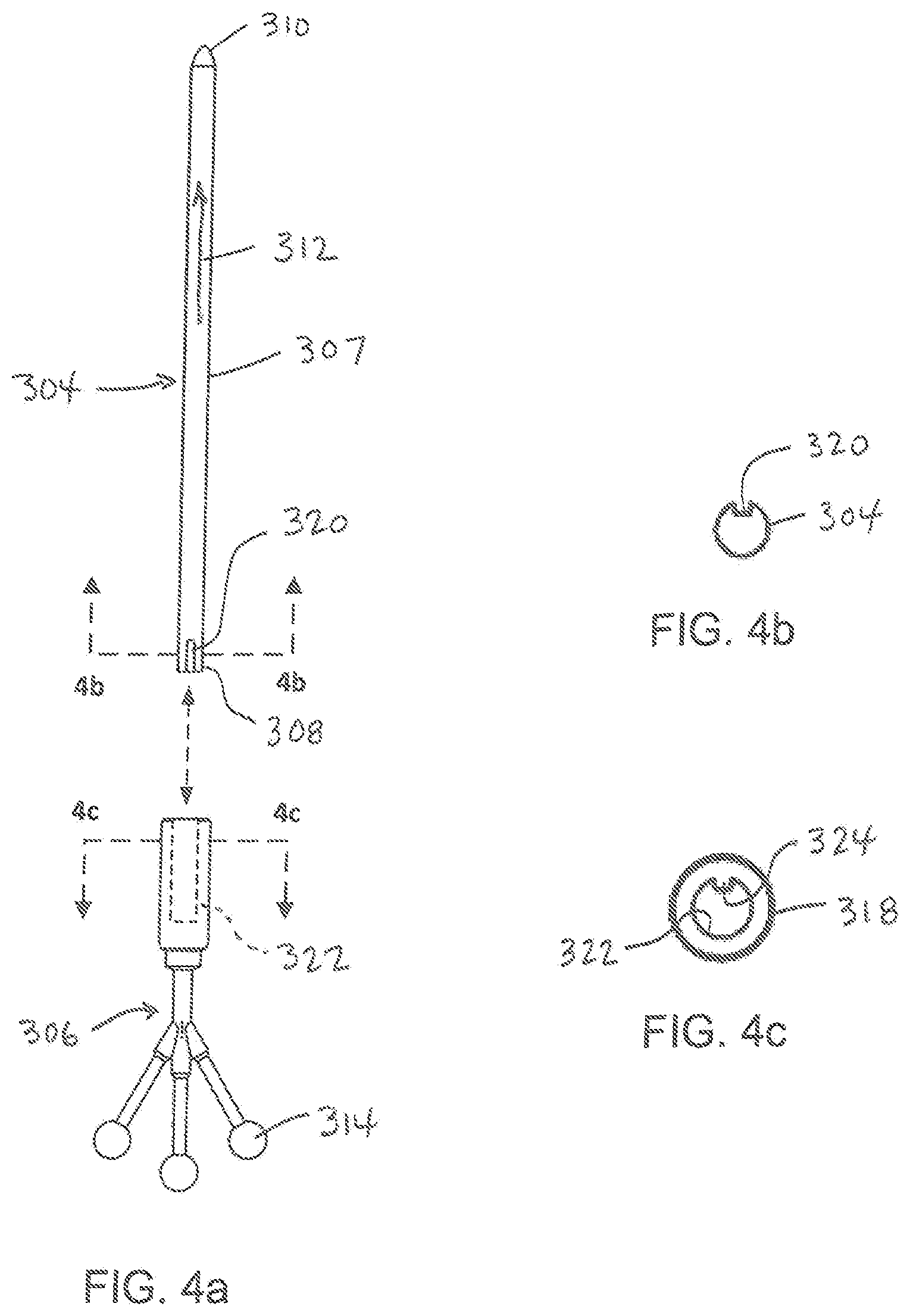 Patent US11779404 Figure 4 – Instrumentation and surgical method for image-guided microendoscopic decompression