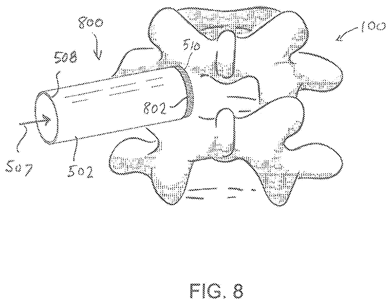 Patent US11779404 Figure 8 – Instrumentation and surgical method for image-guided microendoscopic decompression