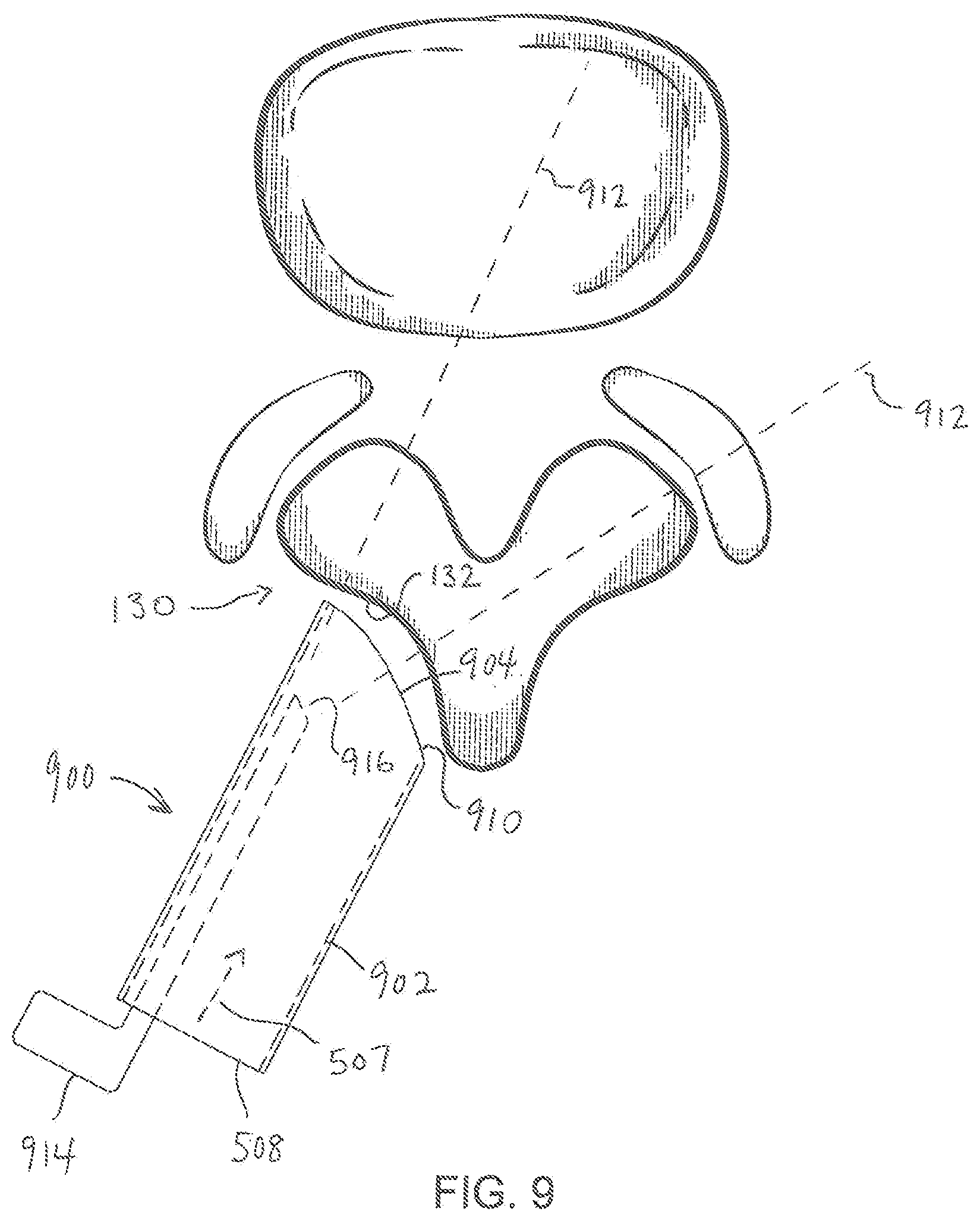 Patent US11779404 Figure 9 – Instrumentation and surgical method for image-guided microendoscopic decompression