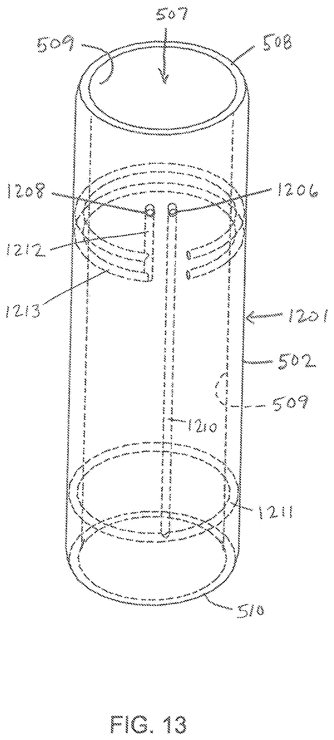 Patent US11779404 Figure 13 – Instrumentation and surgical method for image-guided microendoscopic decompression