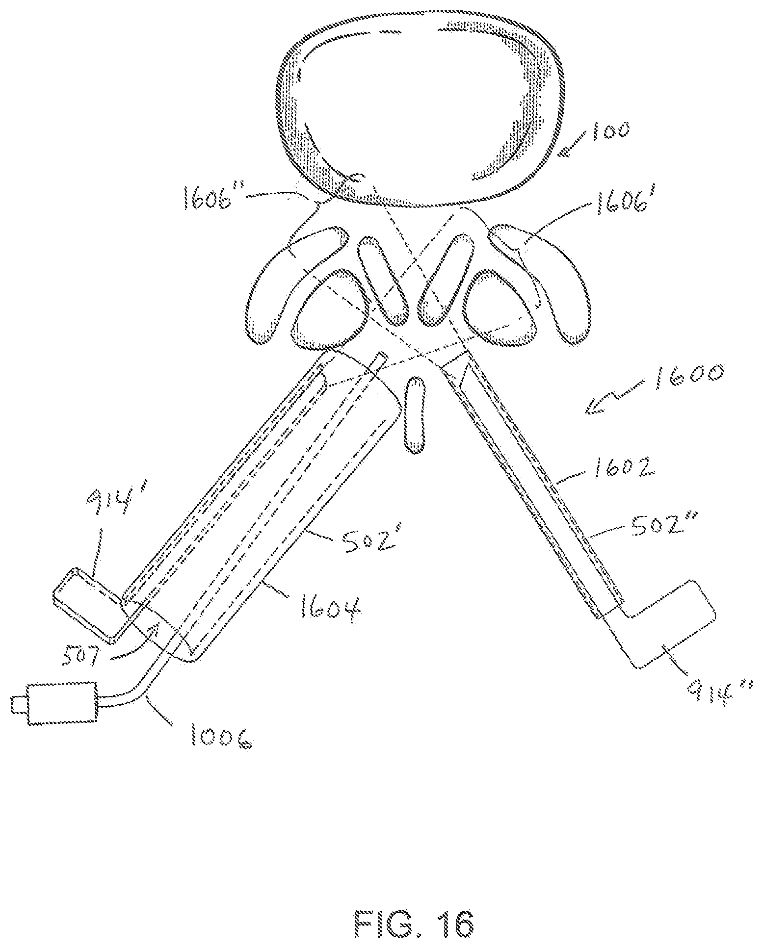 Patent US11779404 Figure 16 – Instrumentation and surgical method for image-guided microendoscopic decompression