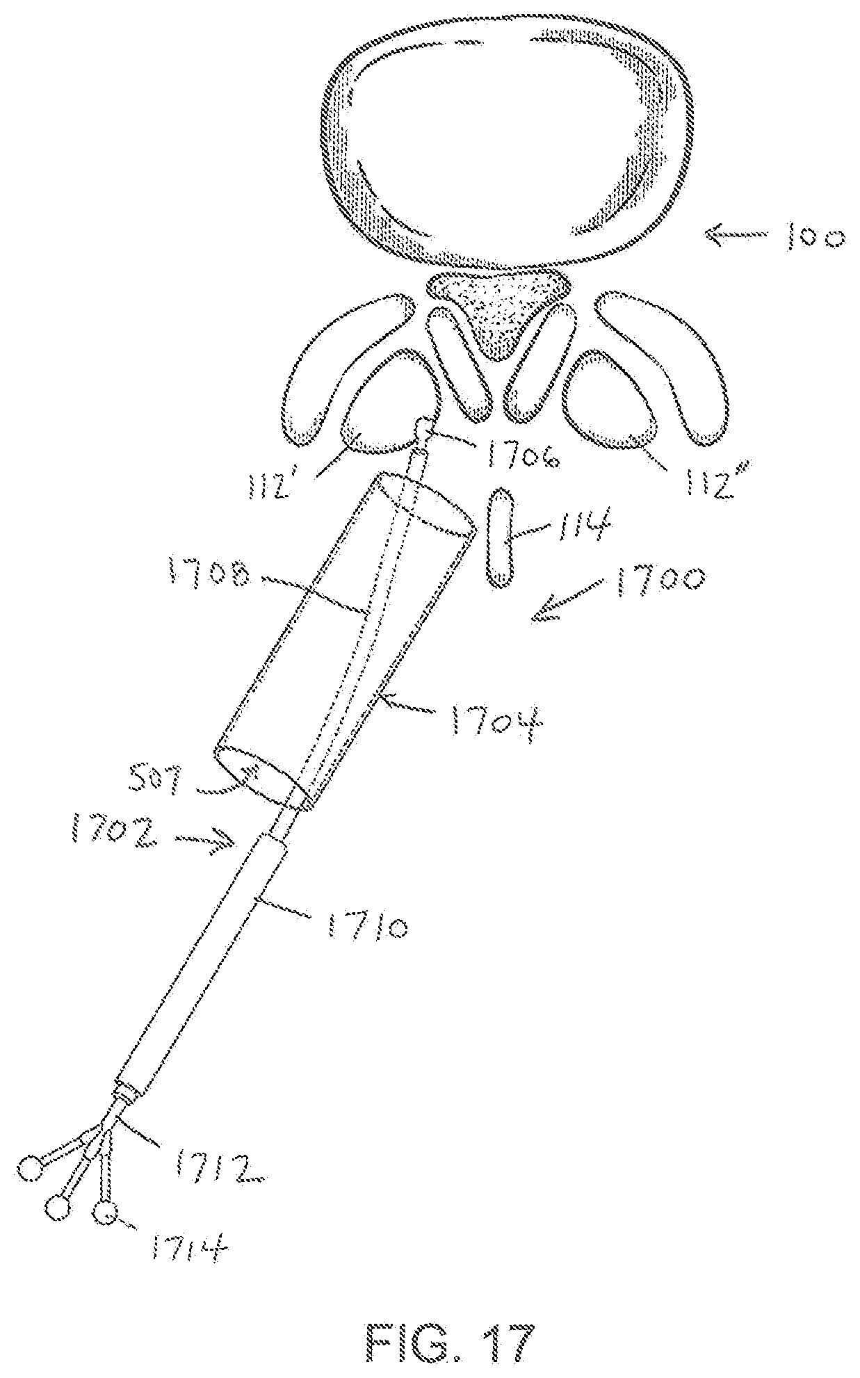 Patent US11779404 Figure 17 – Instrumentation and surgical method for image-guided microendoscopic decompression