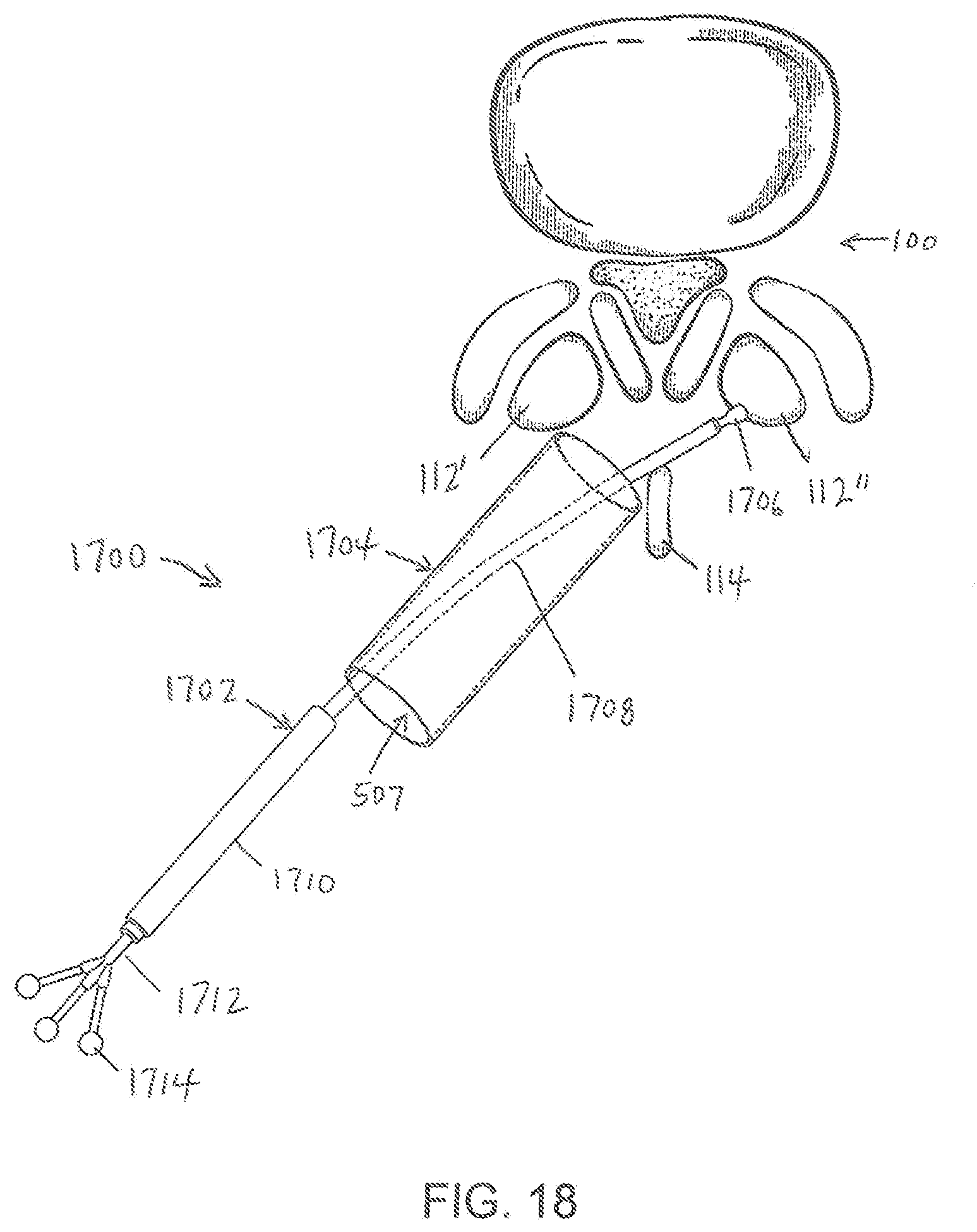 Patent US11779404 Figure 18 – Instrumentation and surgical method for image-guided microendoscopic decompression