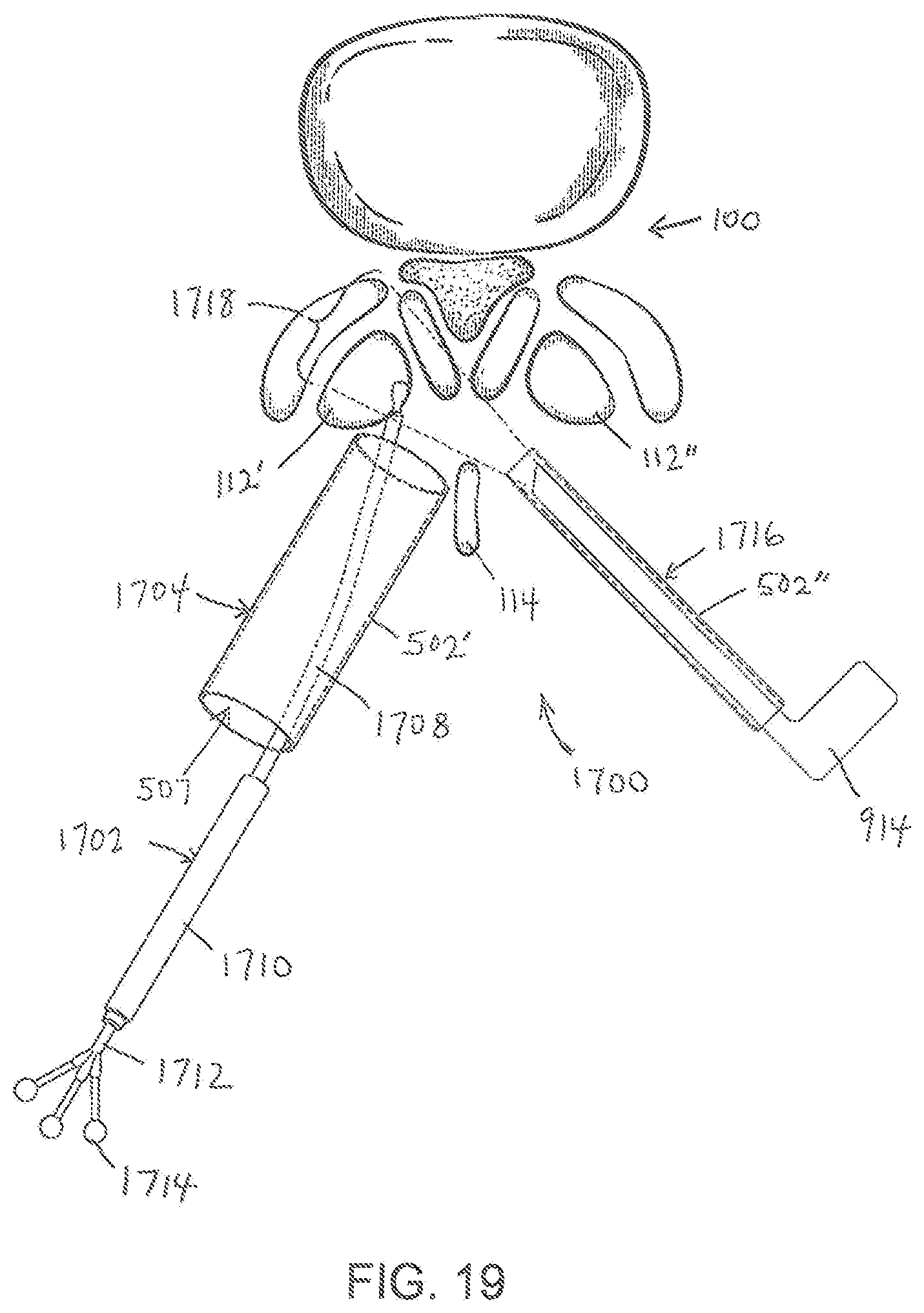 Patent US11779404 Figure 19 – Instrumentation and surgical method for image-guided microendoscopic decompression