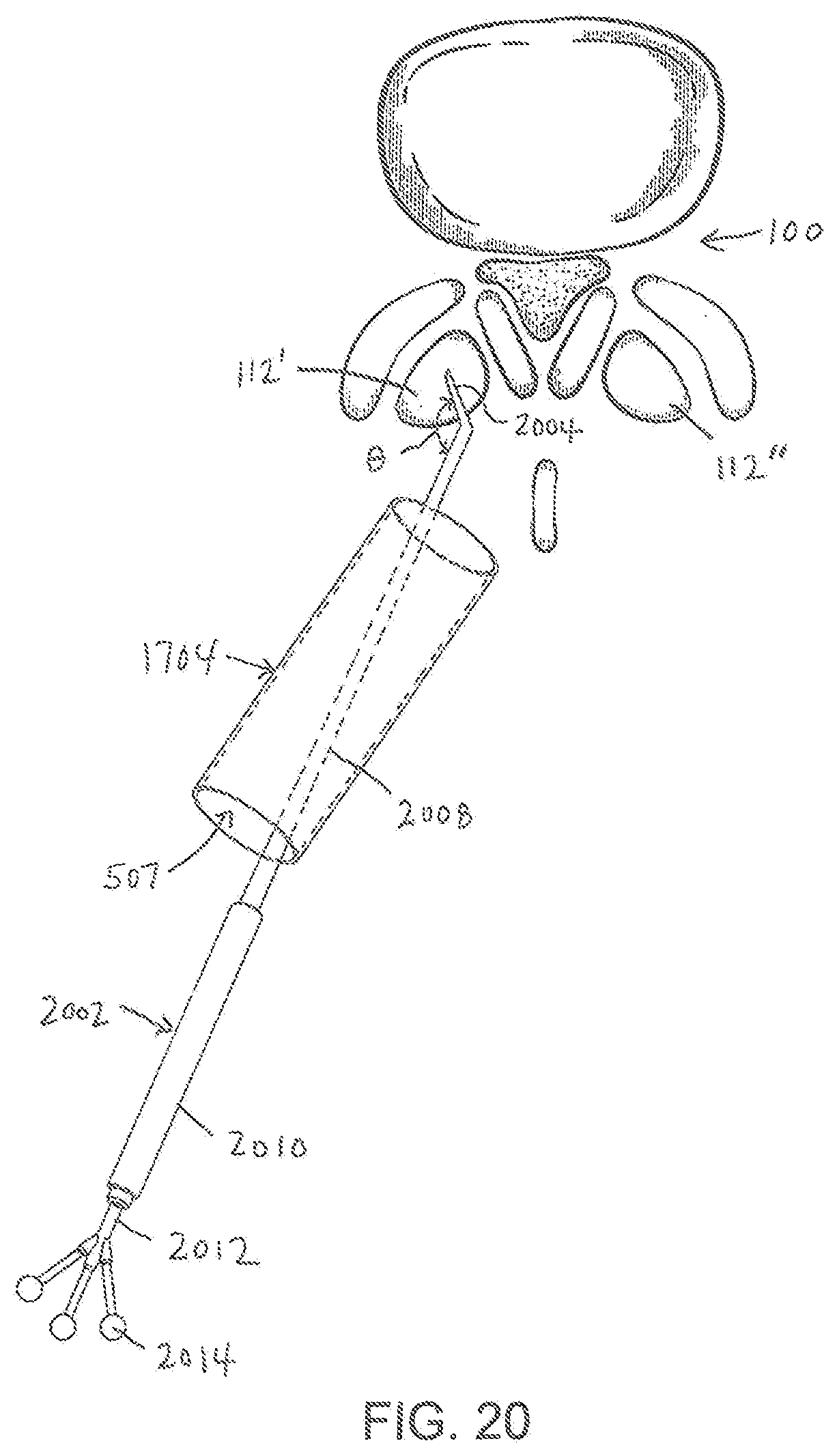 Patent US11779404 Figure 20 – Instrumentation and surgical method for image-guided microendoscopic decompression