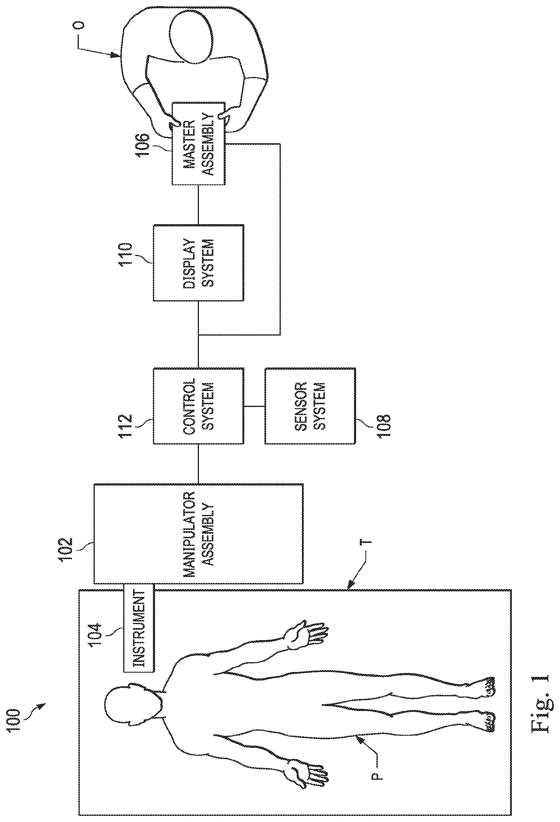 Patent US11779405 Figure 1 – Systems and methods for entry point localization