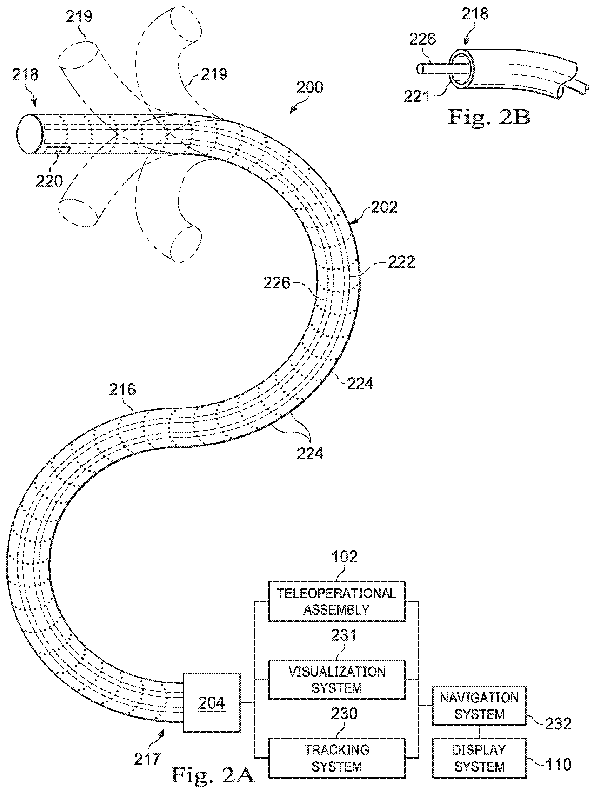 Patent US11779405 Figure 2 – Systems and methods for entry point localization